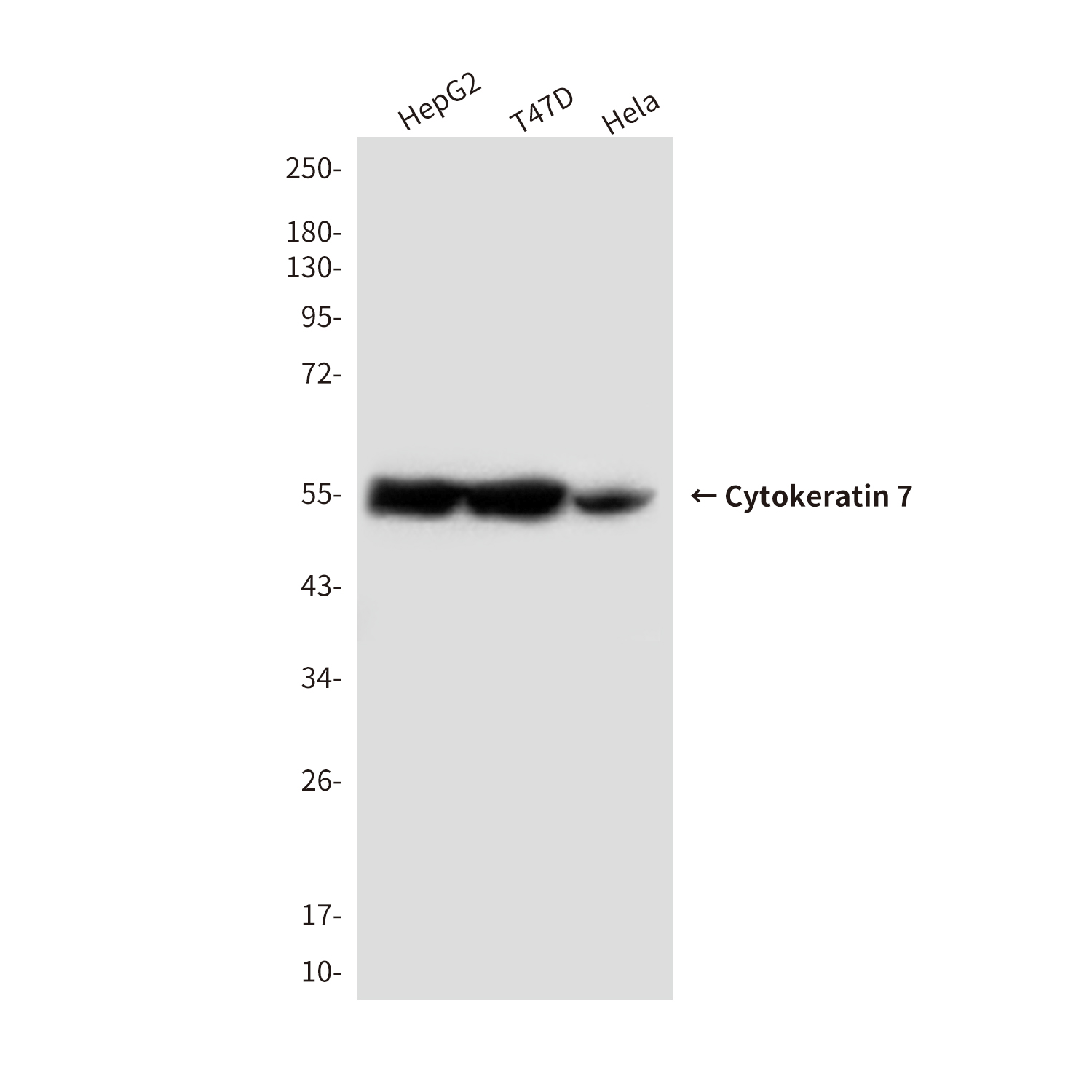 Mouse Monoclonal Antibody to Cytokeratin 7