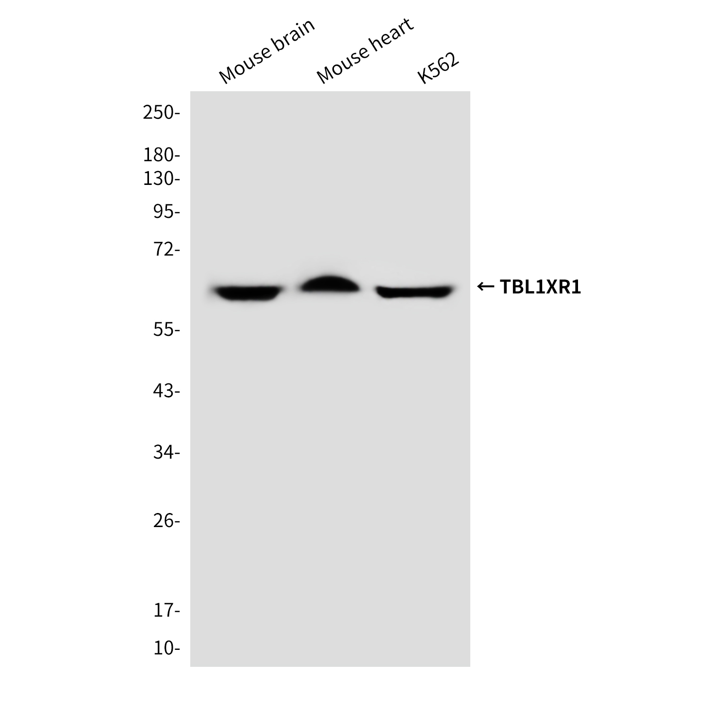 Mouse Monoclonal Antibody to TBL1XR1