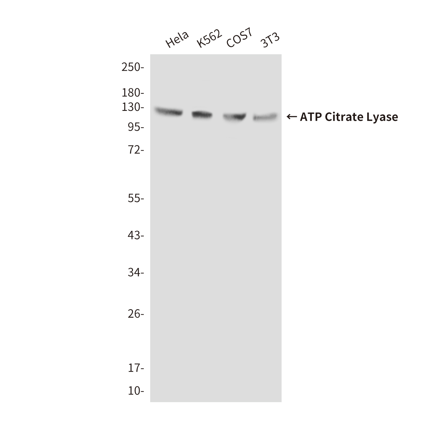 Mouse Monoclonal Antibody to ATP Citrate Lyase