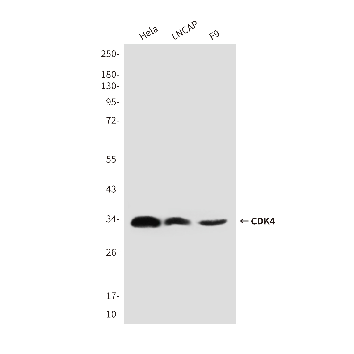 Mouse Monoclonal Antibody to CDK4