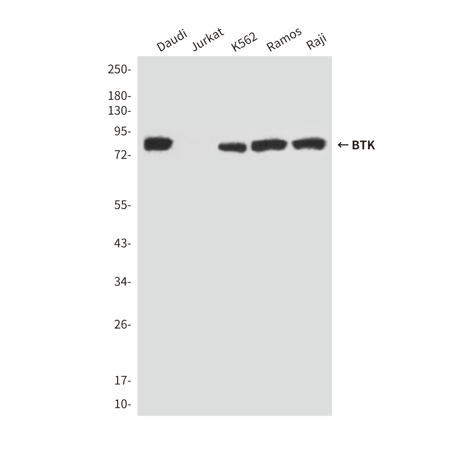 Mouse Monoclonal Antibody to BTK