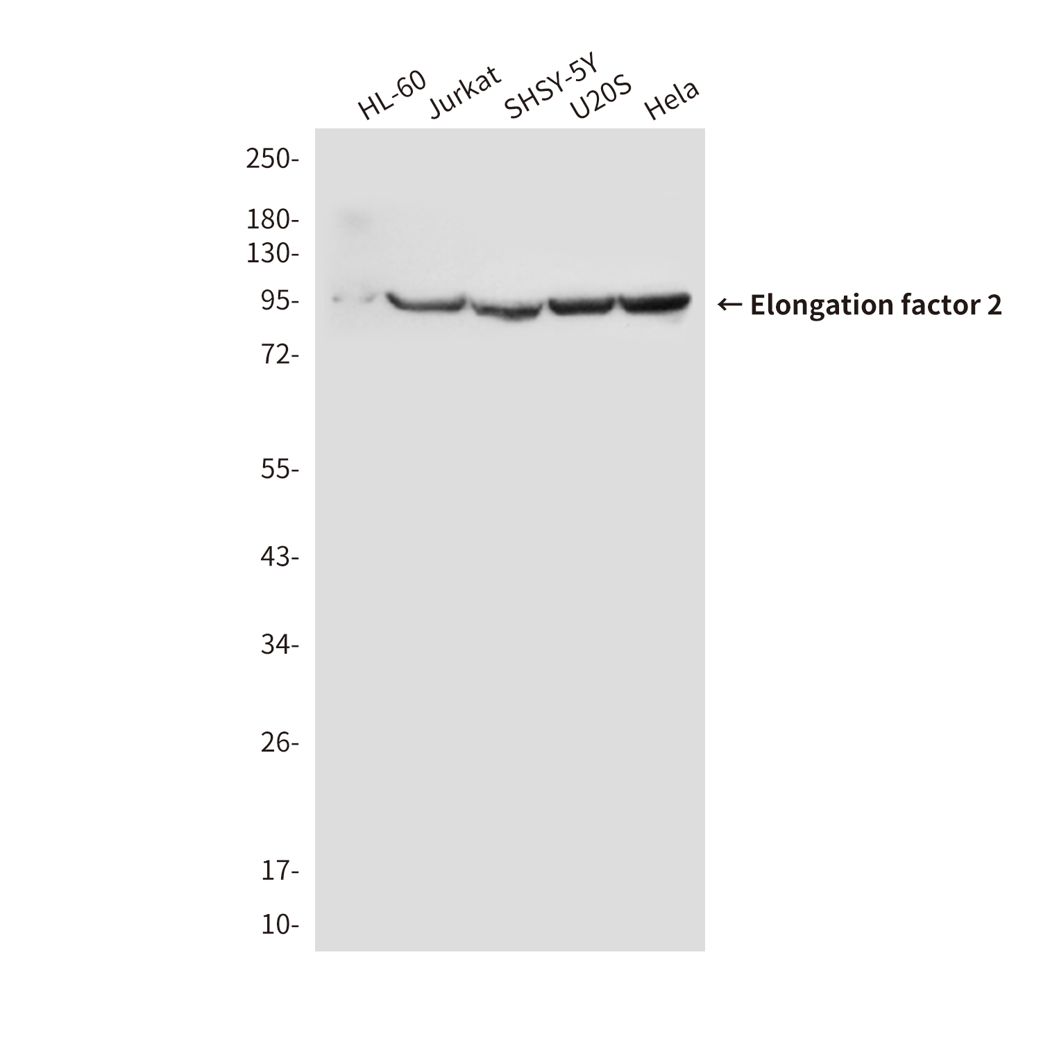 Mouse Monoclonal Antibody to Elongation factor 2