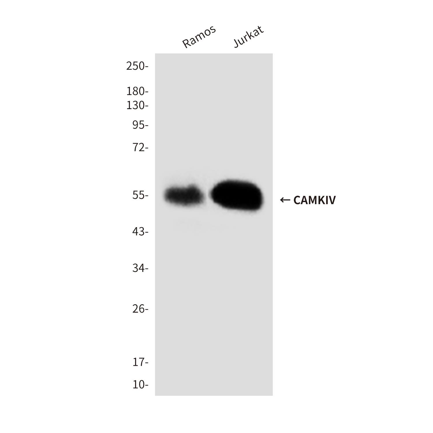 Mouse Monoclonal Antibody to CAMKIV