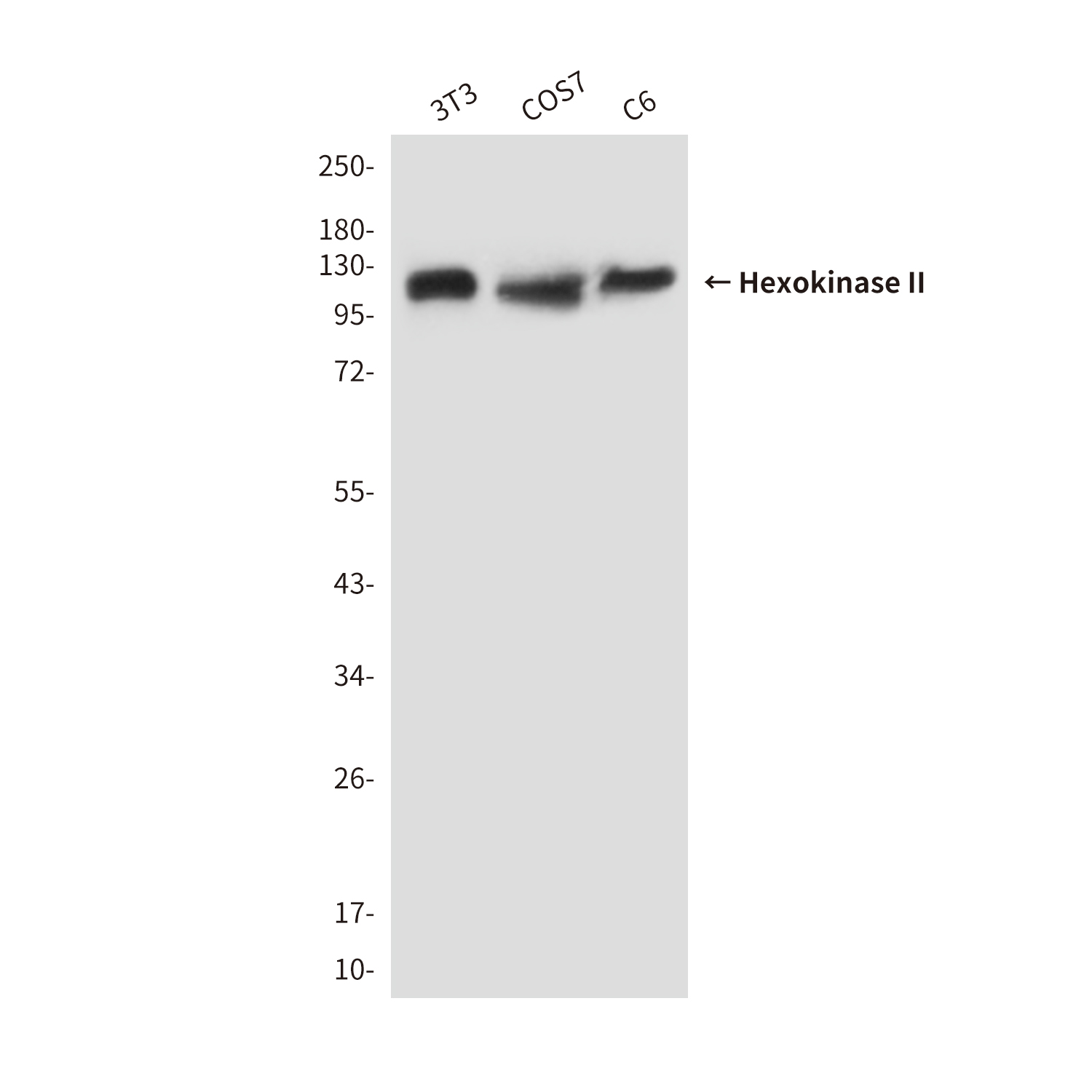 Mouse Monoclonal Antibody to Hexokinase II