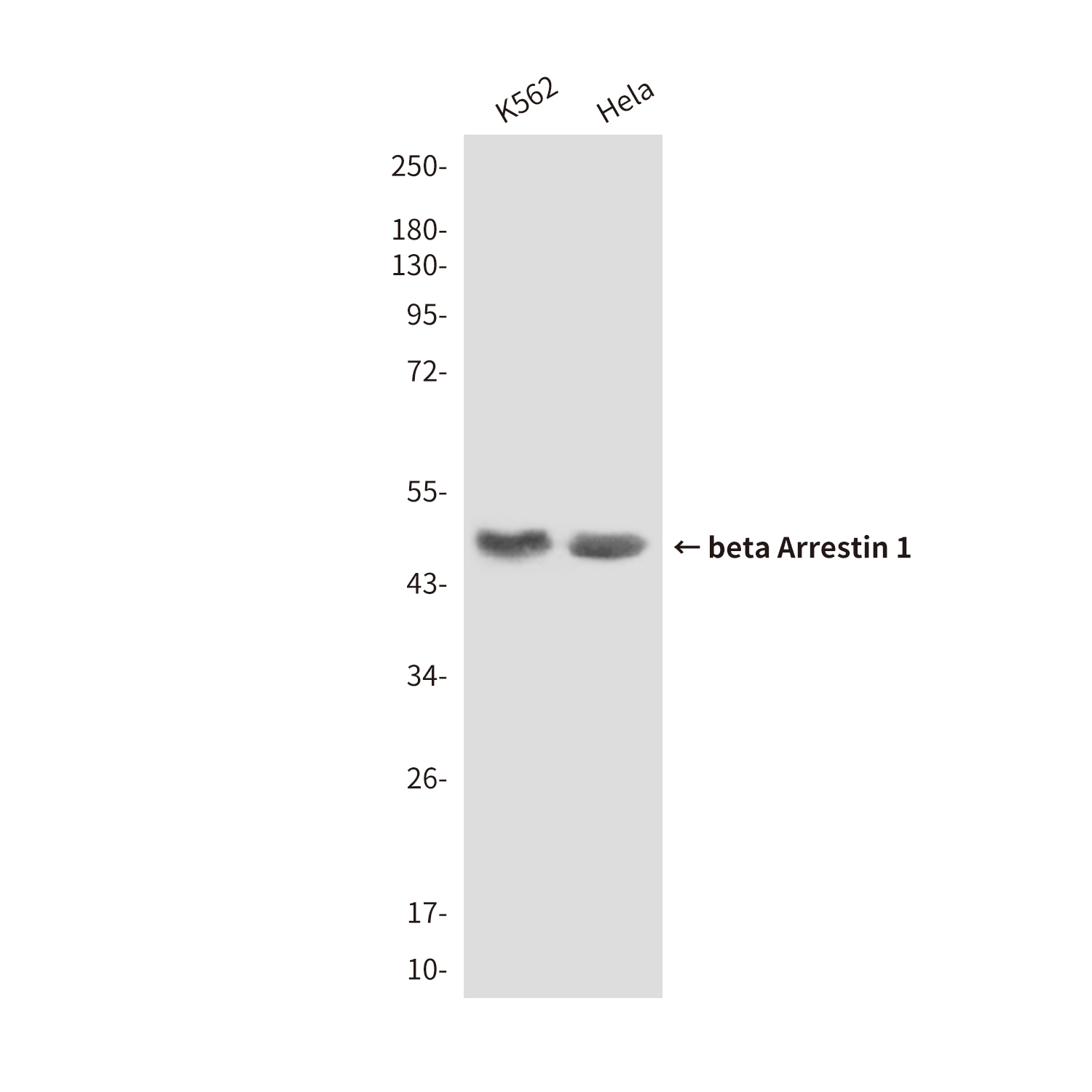 Mouse Monoclonal Antibody to beta Arrestin 1
