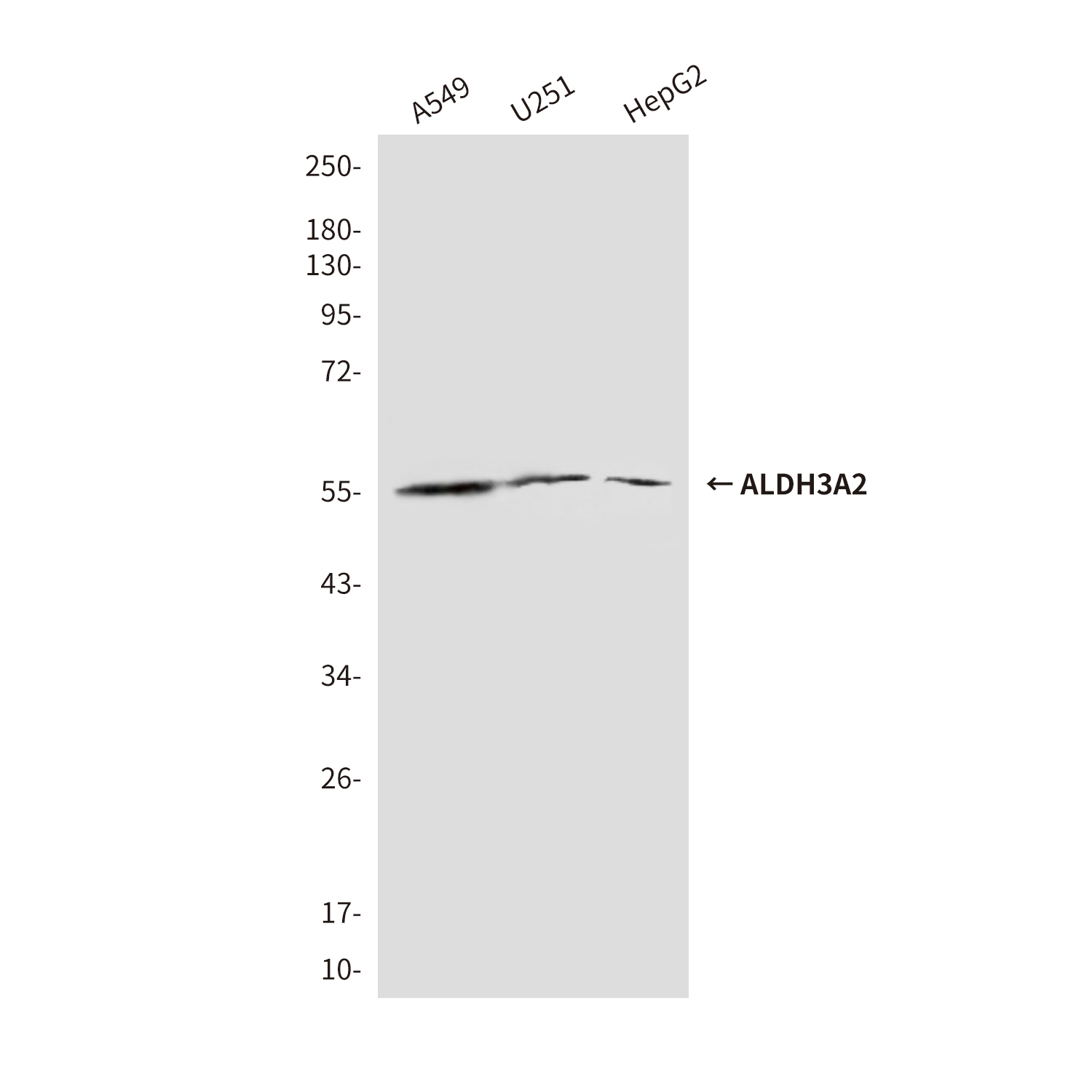 Mouse Monoclonal Antibody to ALDH3A2