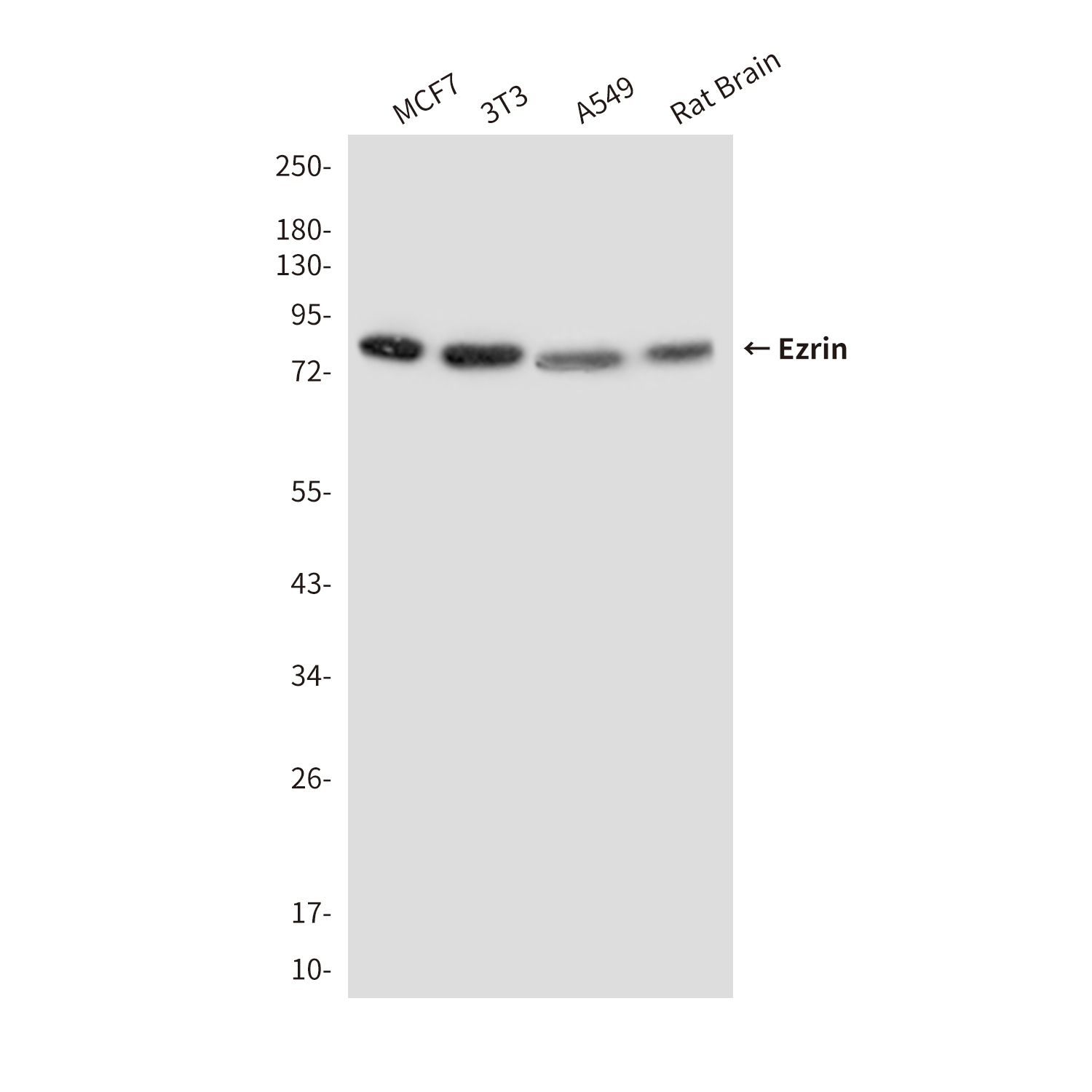 Mouse Monoclonal Antibody to Ezrin