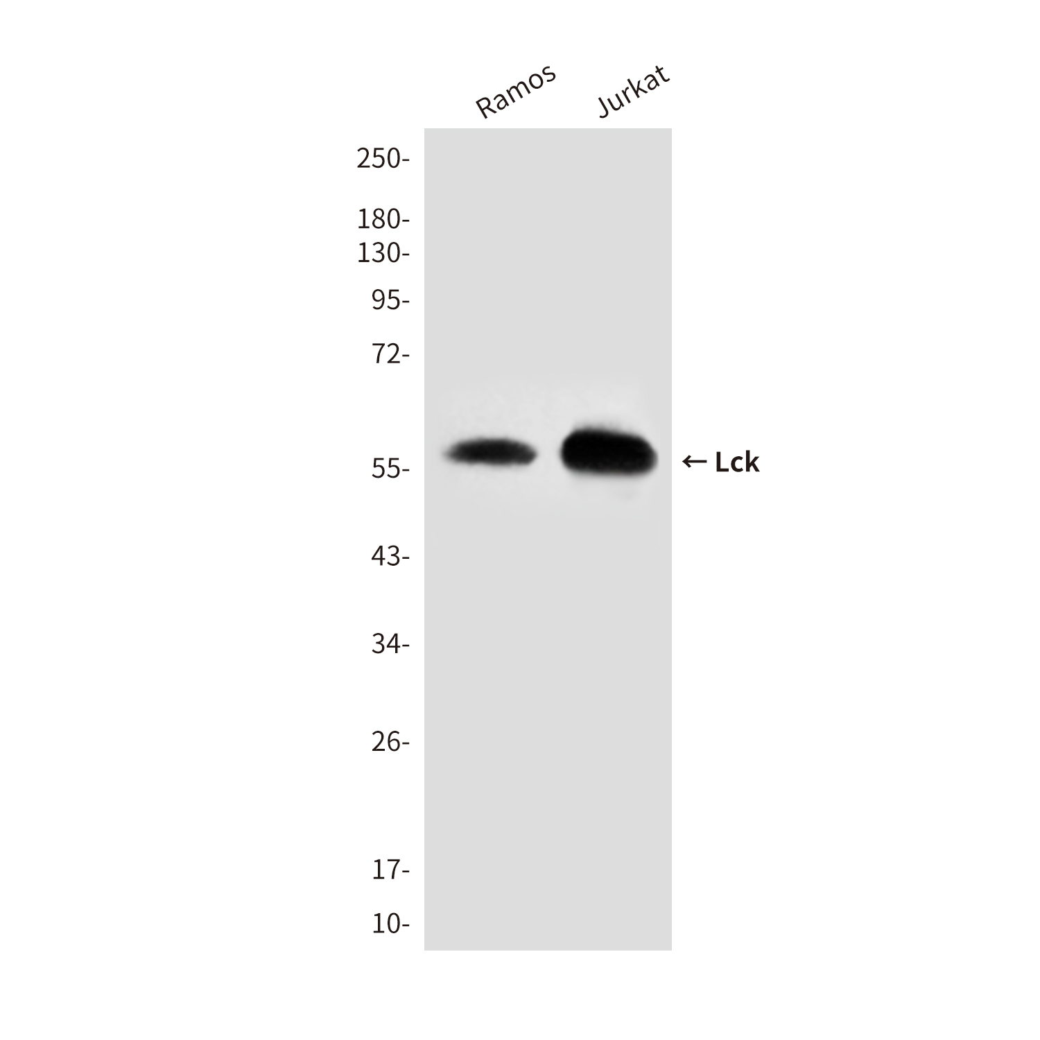 Mouse Monoclonal Antibody to Lck