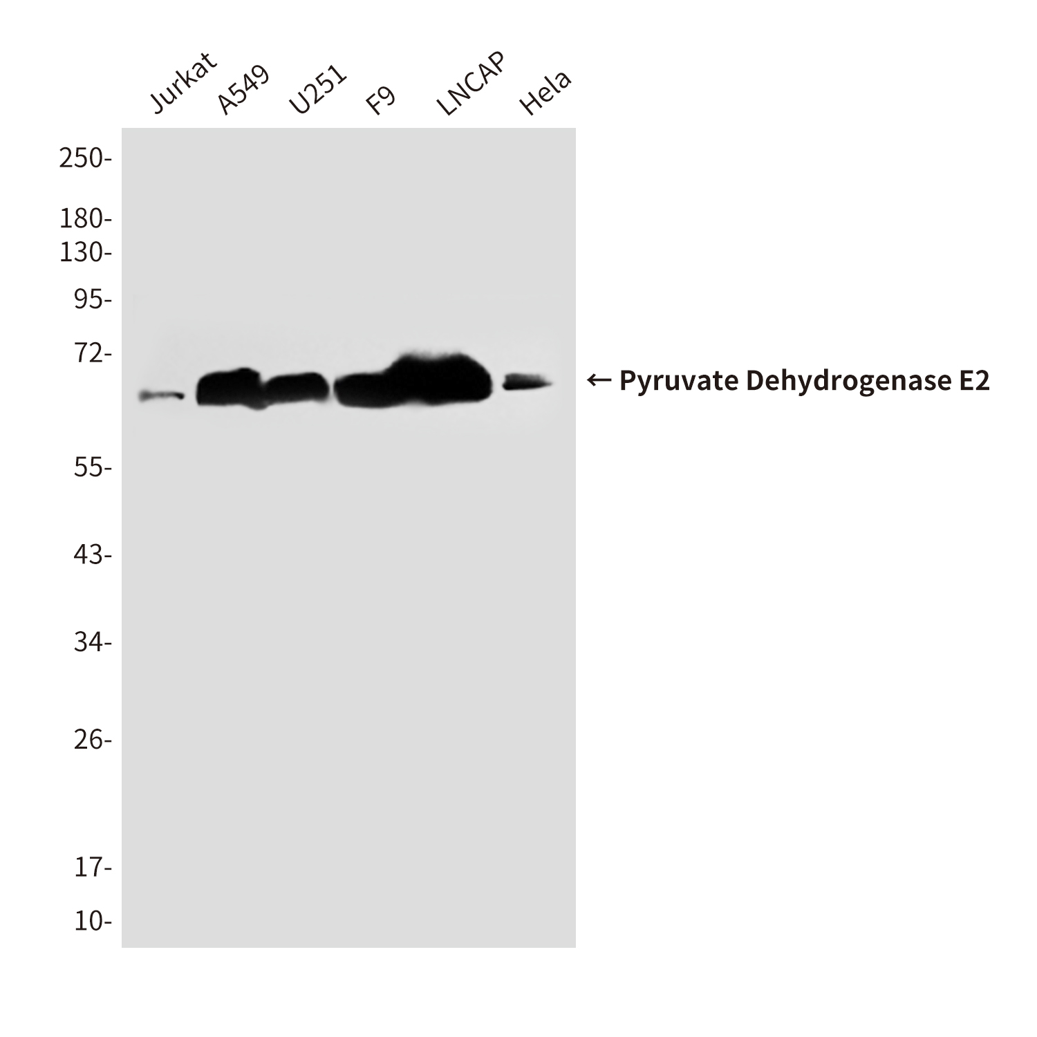 Mouse Monoclonal Antibody to Pyruvate Dehydrogenase E2