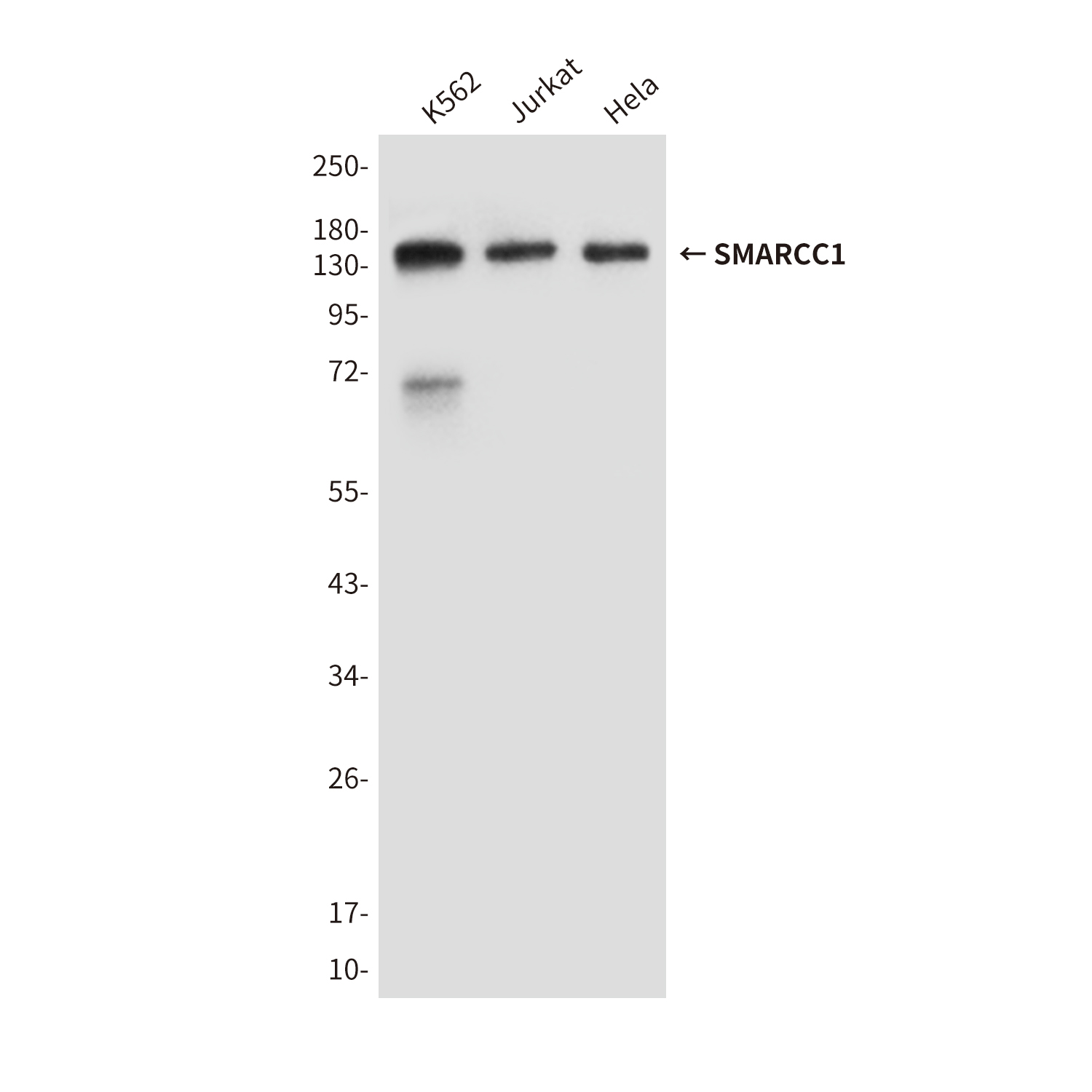 Mouse Monoclonal Antibody to SMARCC1