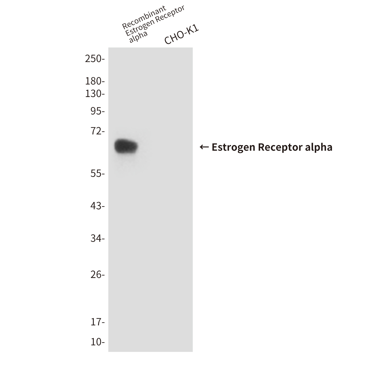 Mouse Monoclonal Antibody to Estrogen Receptor alpha