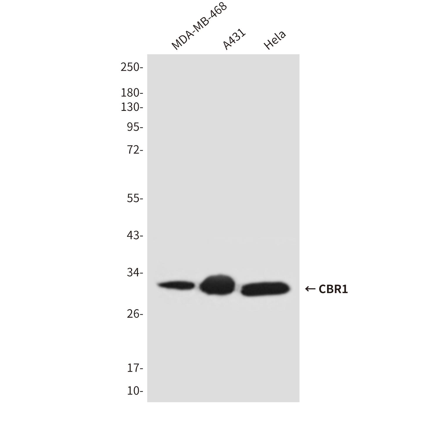 Mouse Monoclonal Antibody to CBR1