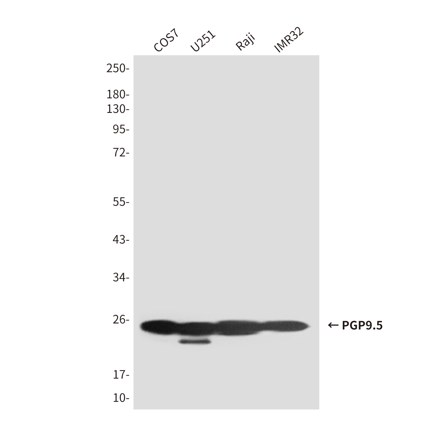 Mouse Monoclonal Antibody to PGP9.5