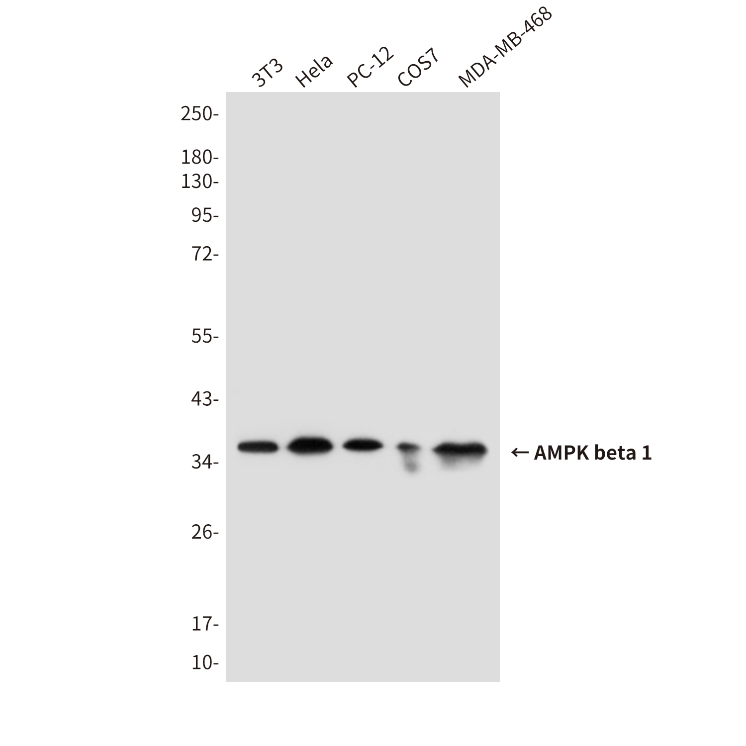 Mouse Monoclonal Antibody to AMPK beta 1