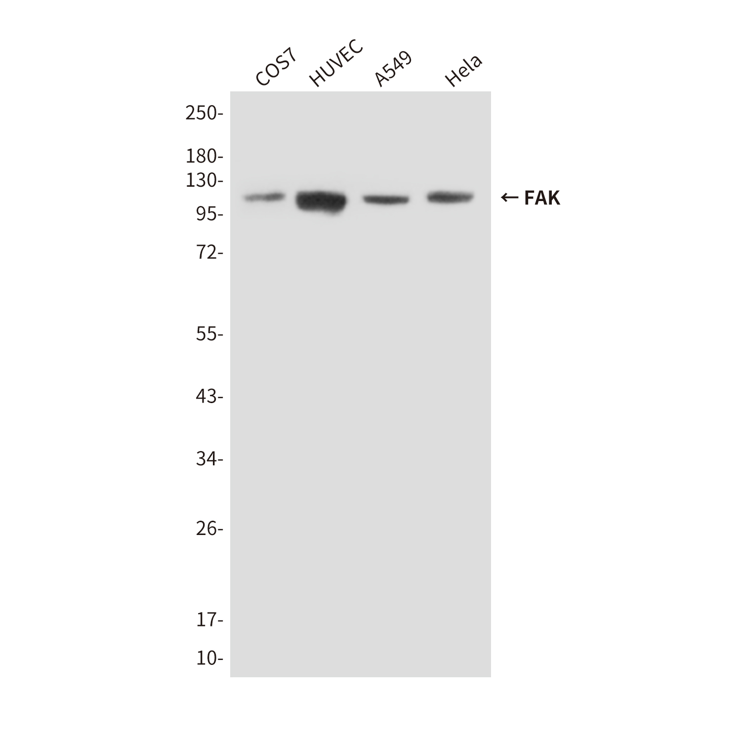 Mouse Monoclonal Antibody to FAK