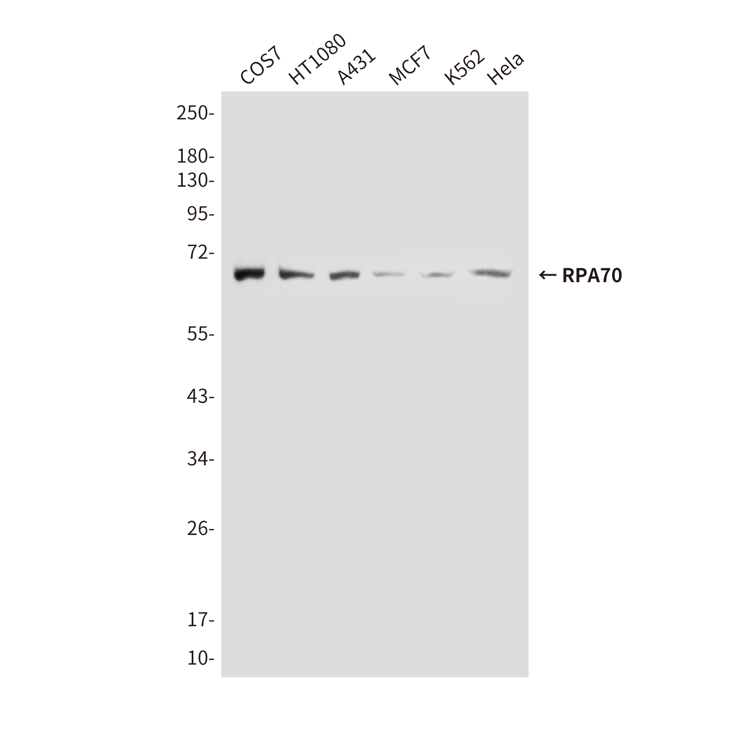 Mouse Monoclonal Antibody to RPA70