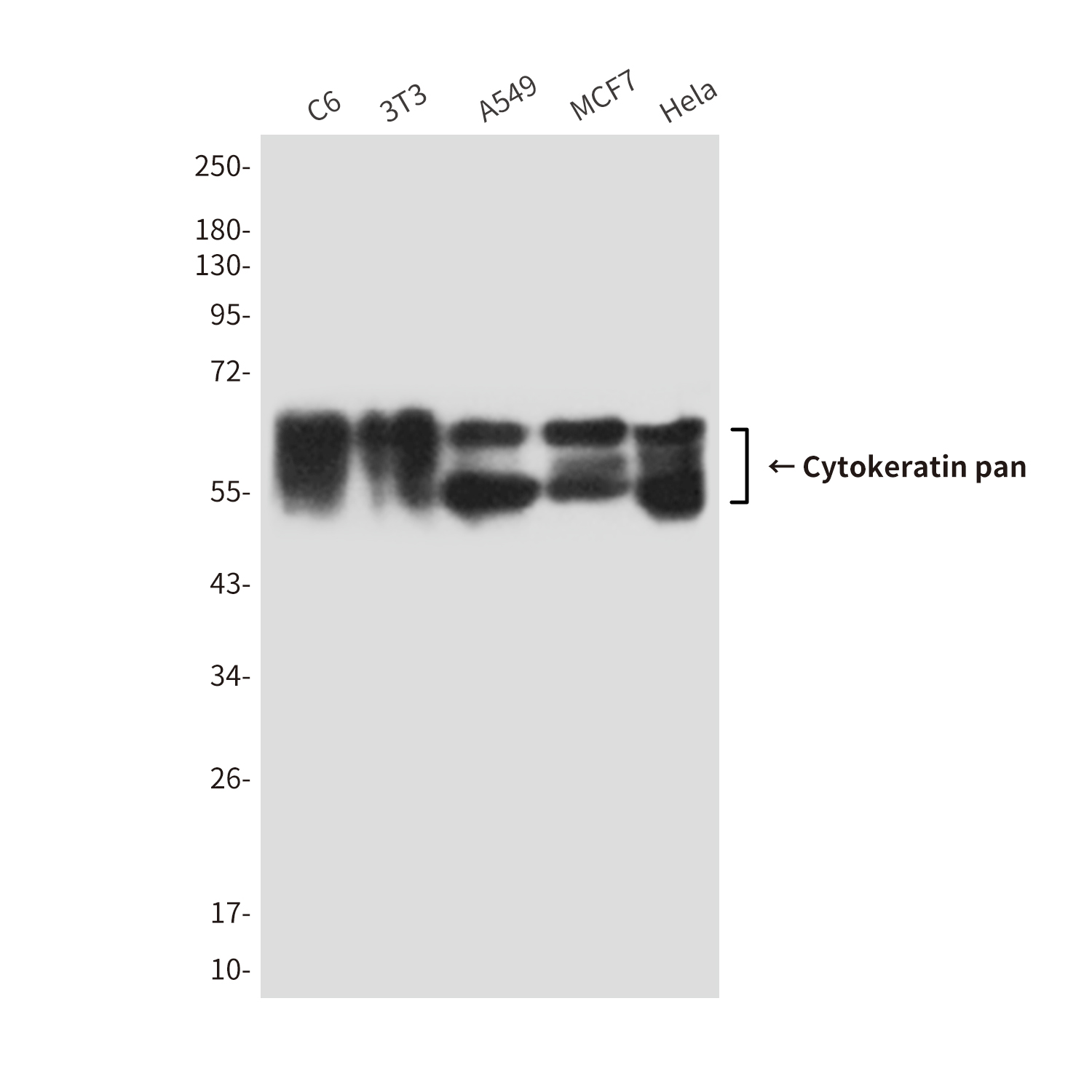 Mouse Monoclonal Antibody to Cytokeratin pan