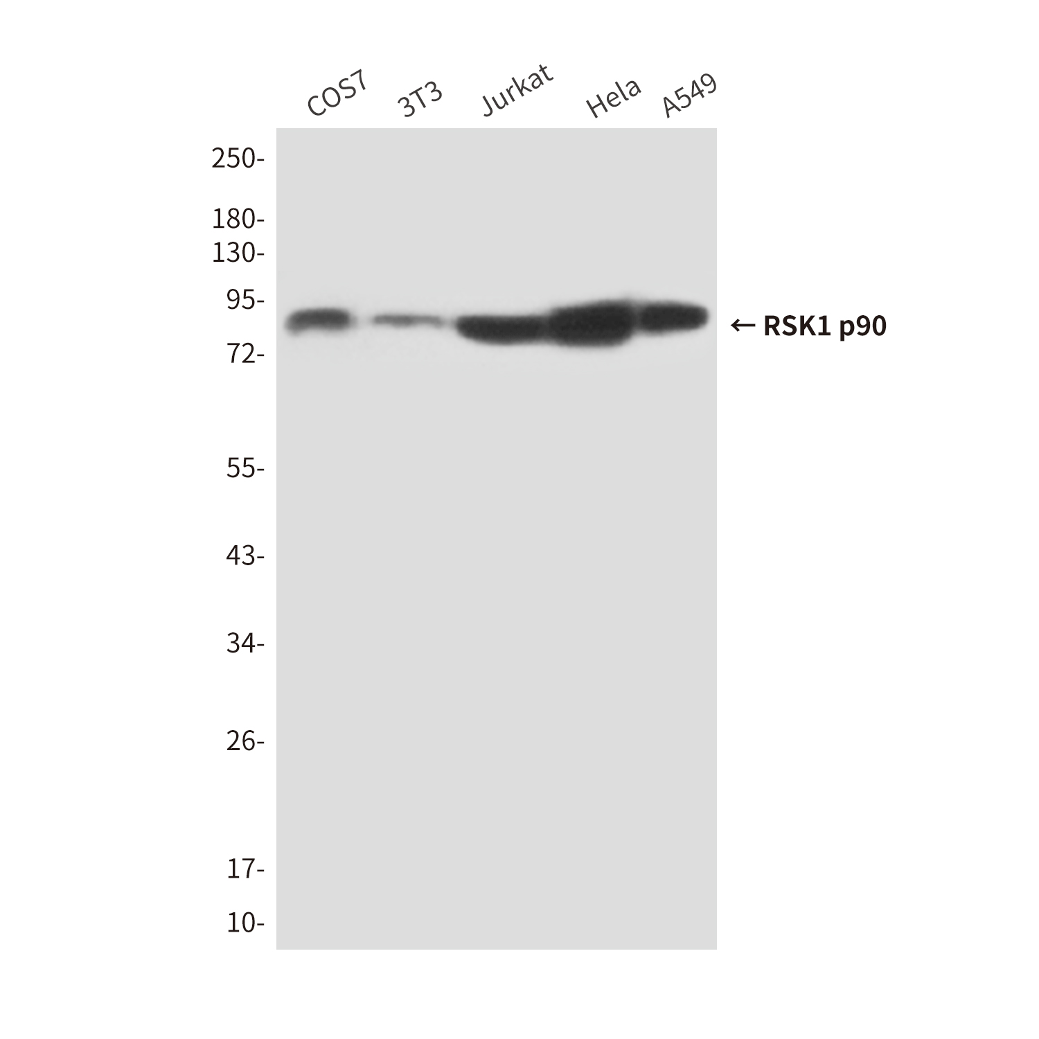 Mouse Monoclonal Antibody to RSK1 p90