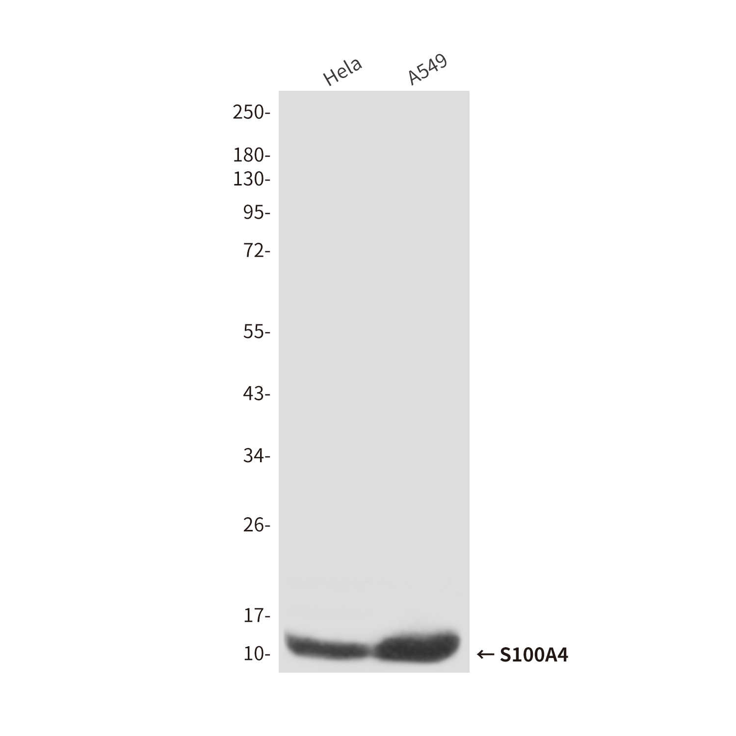 Mouse Monoclonal Antibody to S100A4