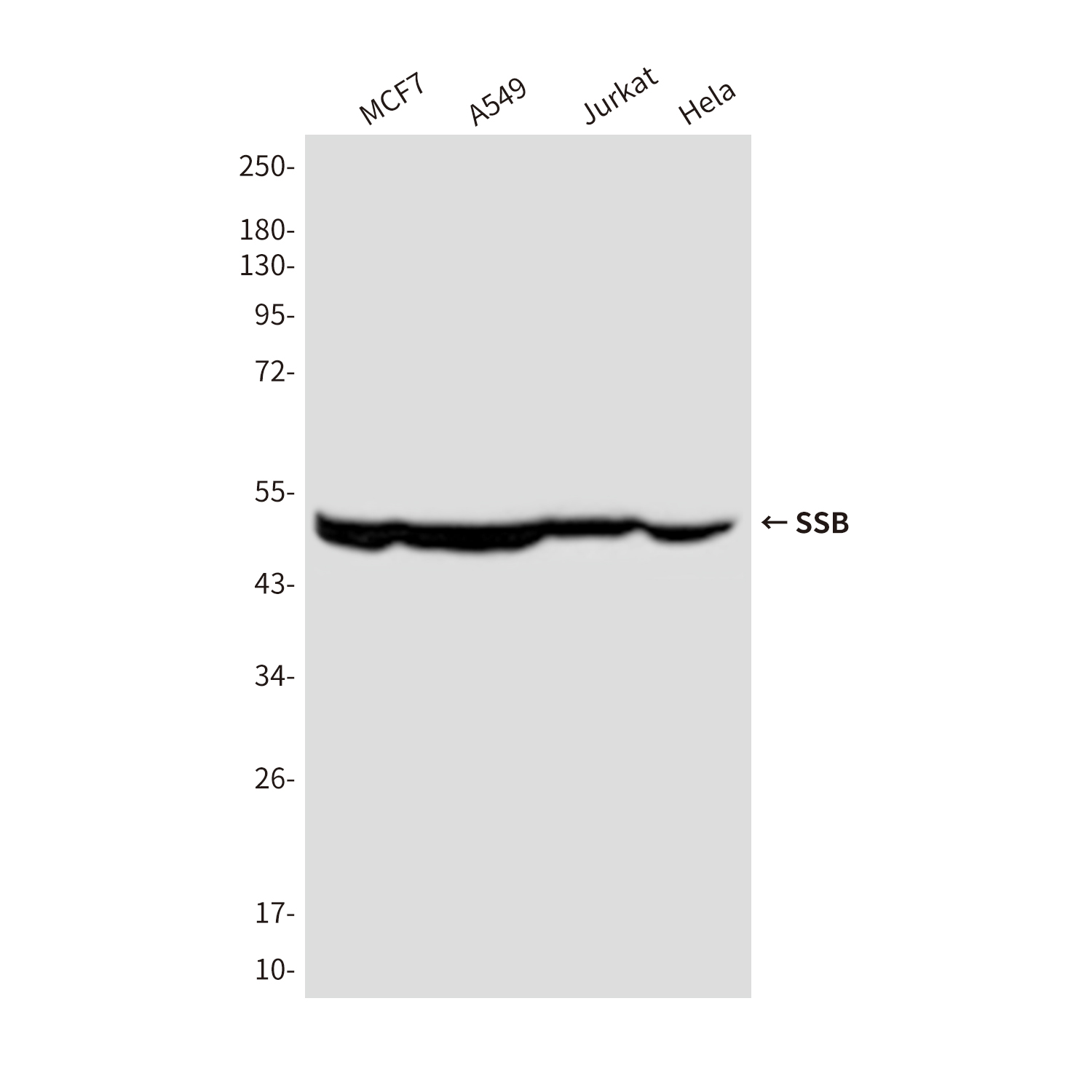 Mouse Monoclonal Antibody to SSB