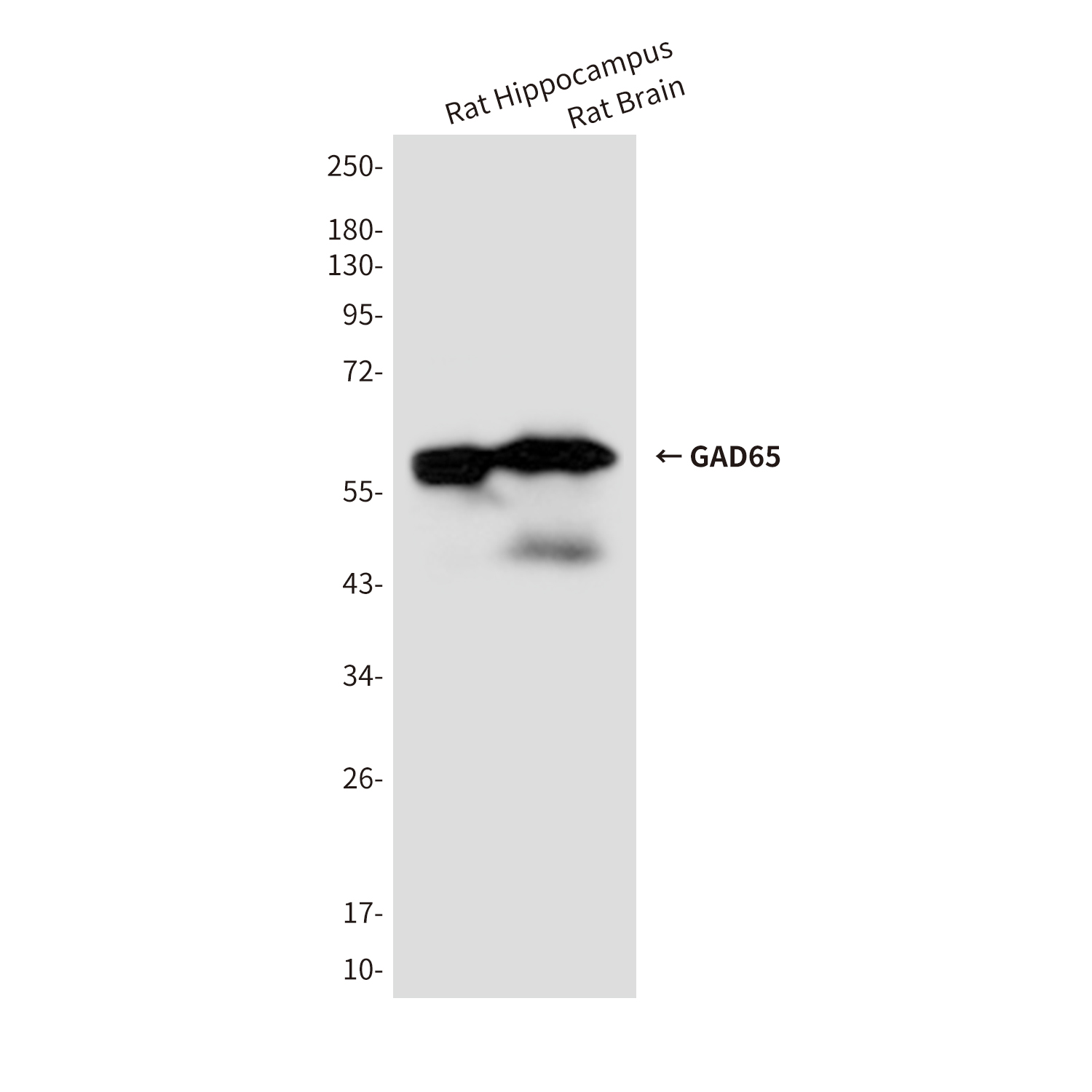 Mouse Monoclonal Antibody to GAD65