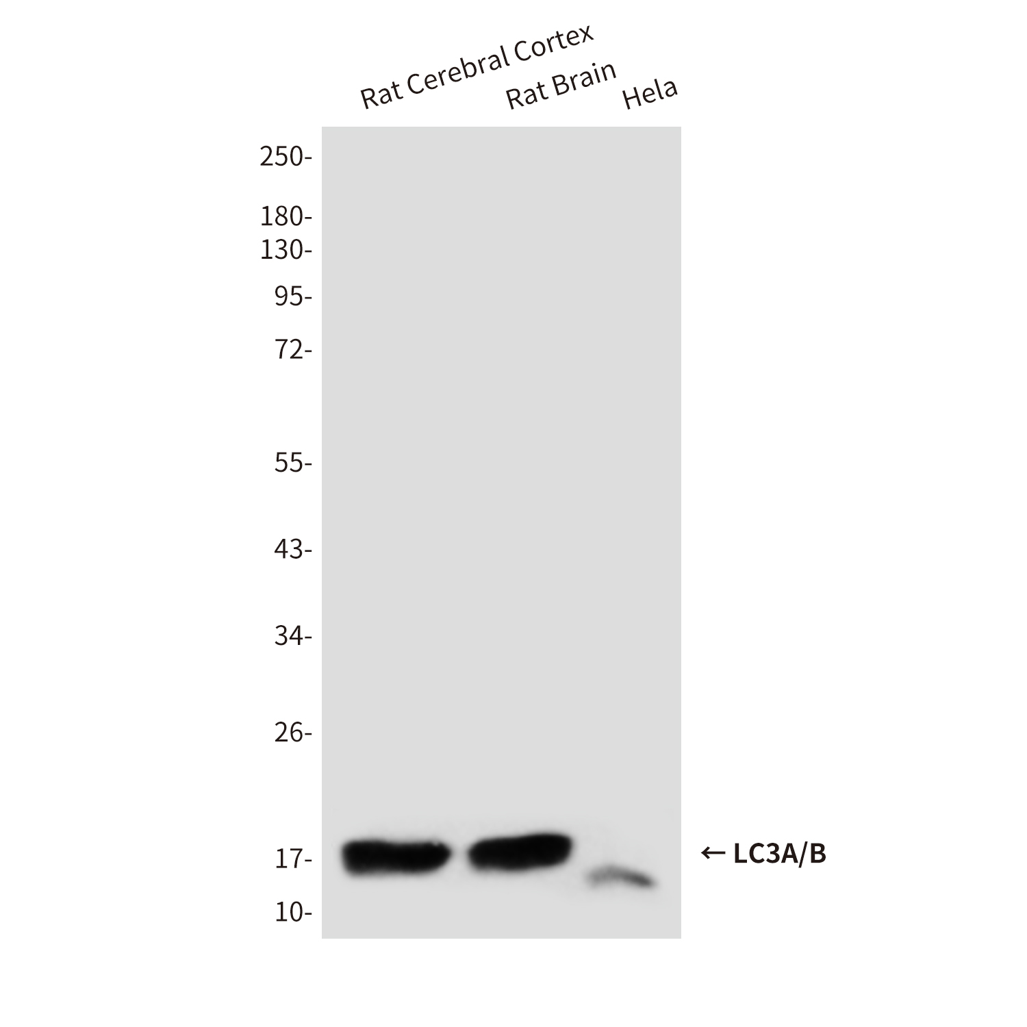 Mouse Monoclonal Antibody to LC3A/B