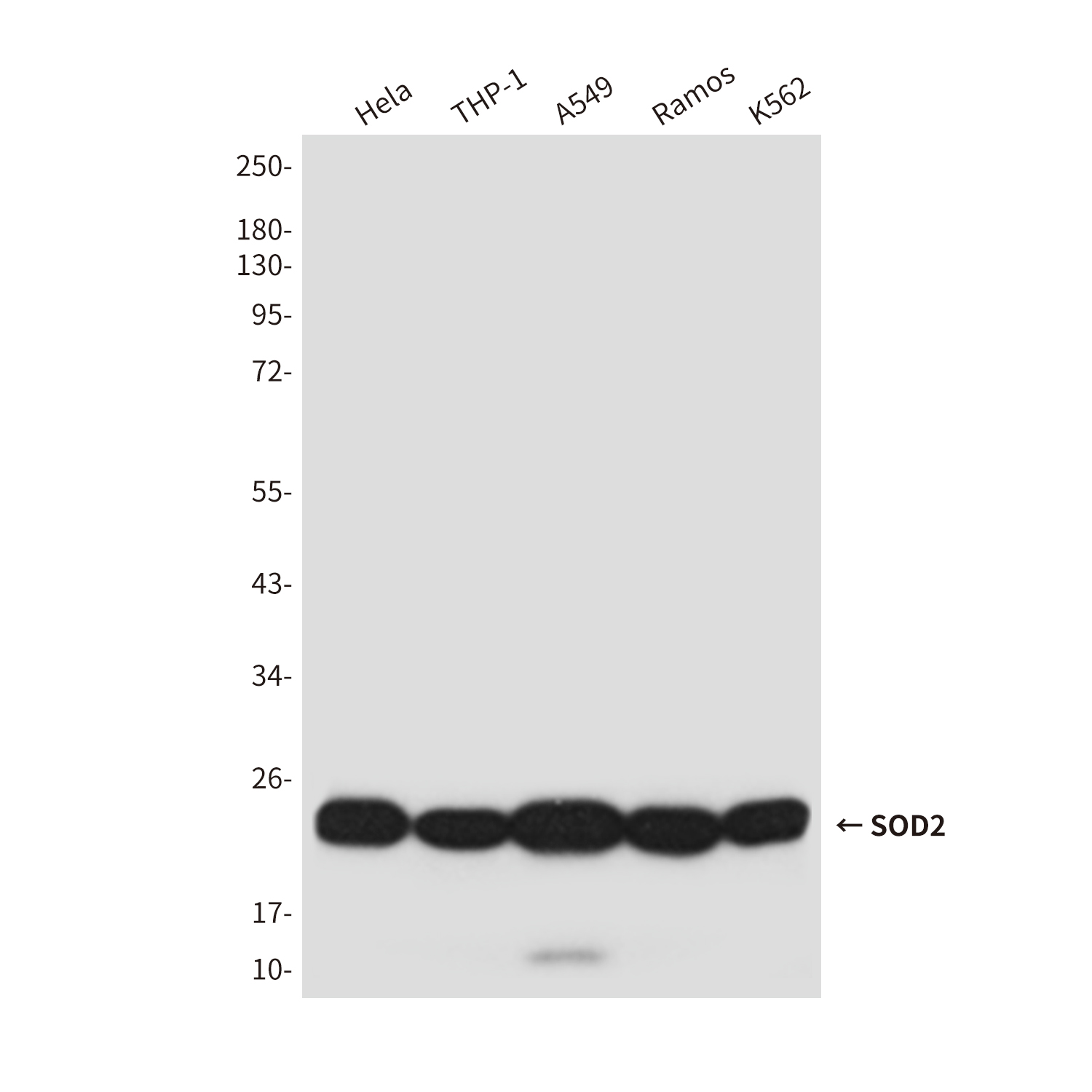 Mouse Monoclonal Antibody to SOD2