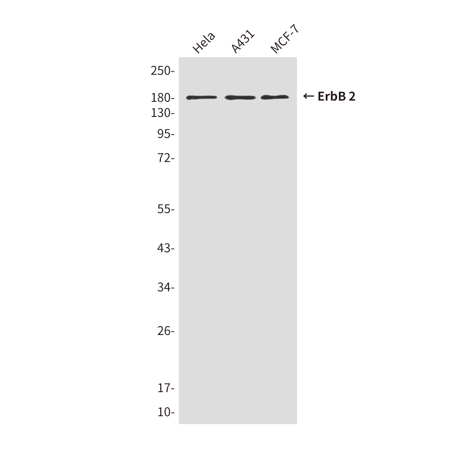 Mouse Monoclonal Antibody to ErbB 2