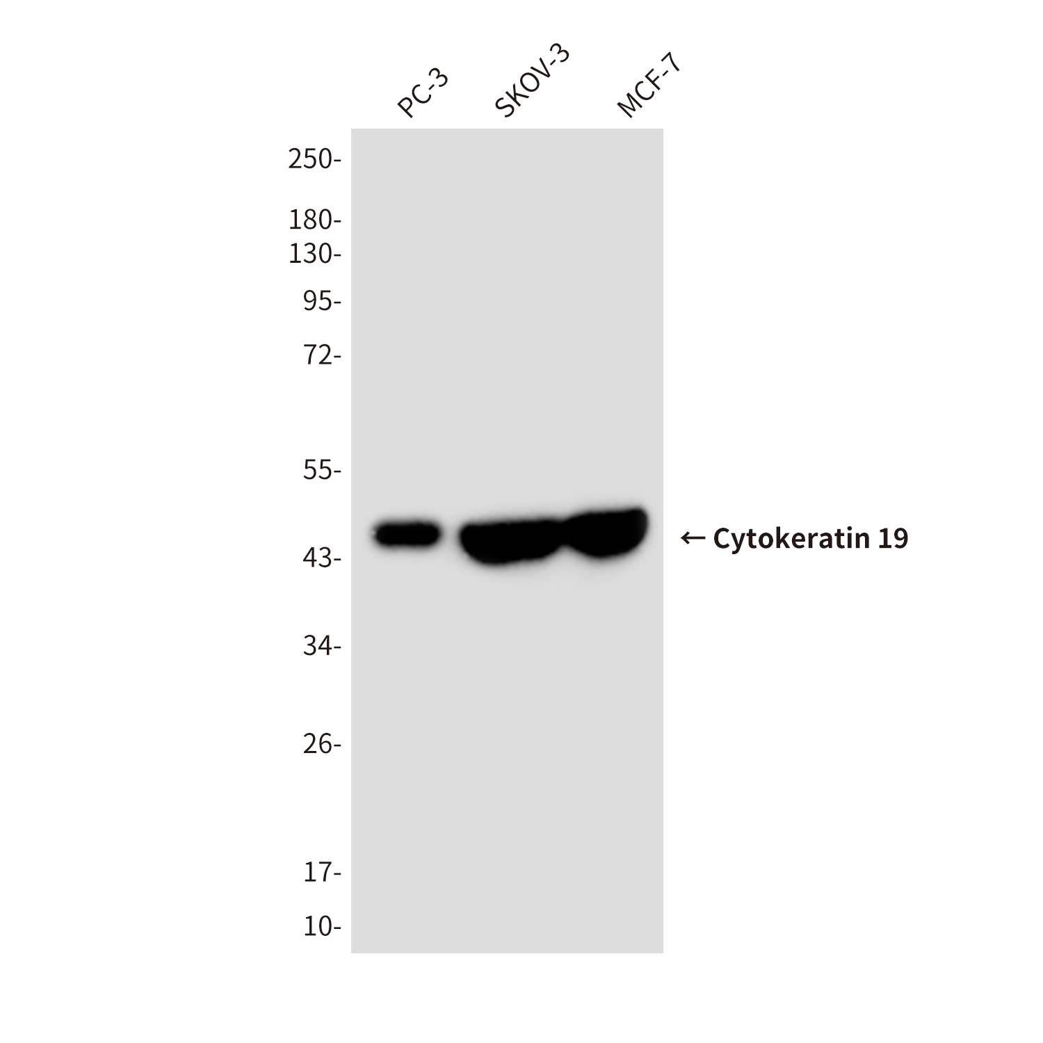 Mouse Monoclonal Antibody to Cytokeratin 19
