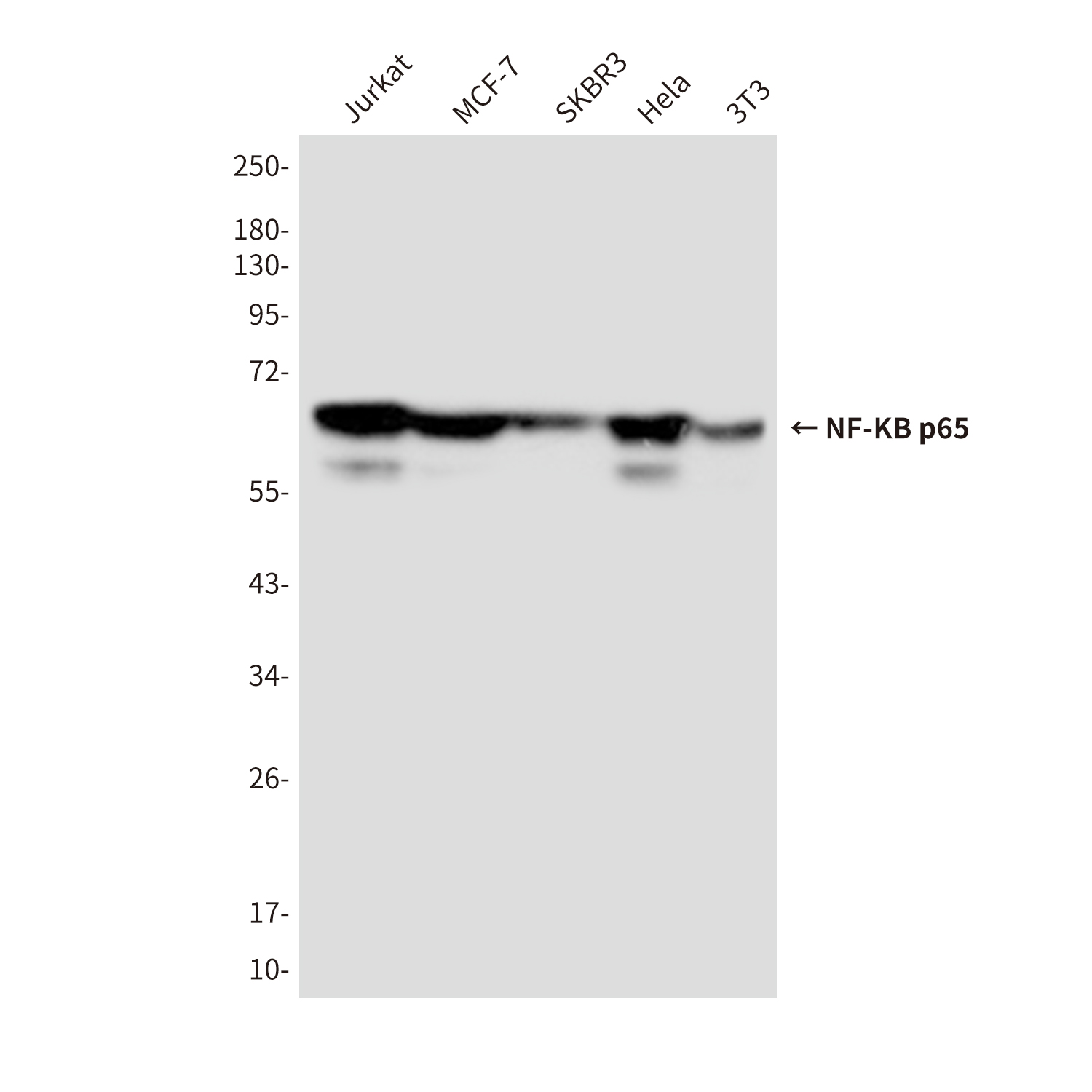 Mouse Monoclonal Antibody to NF-KB p65