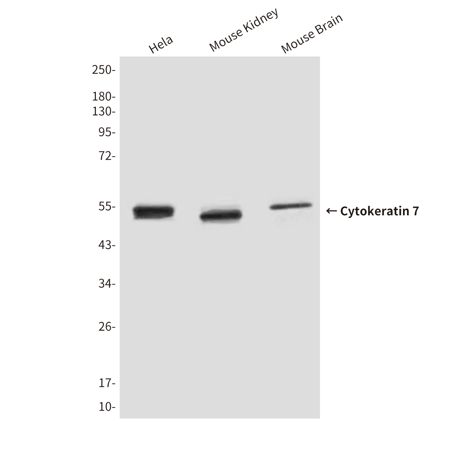 Mouse Monoclonal Antibody to Cytokeratin 7