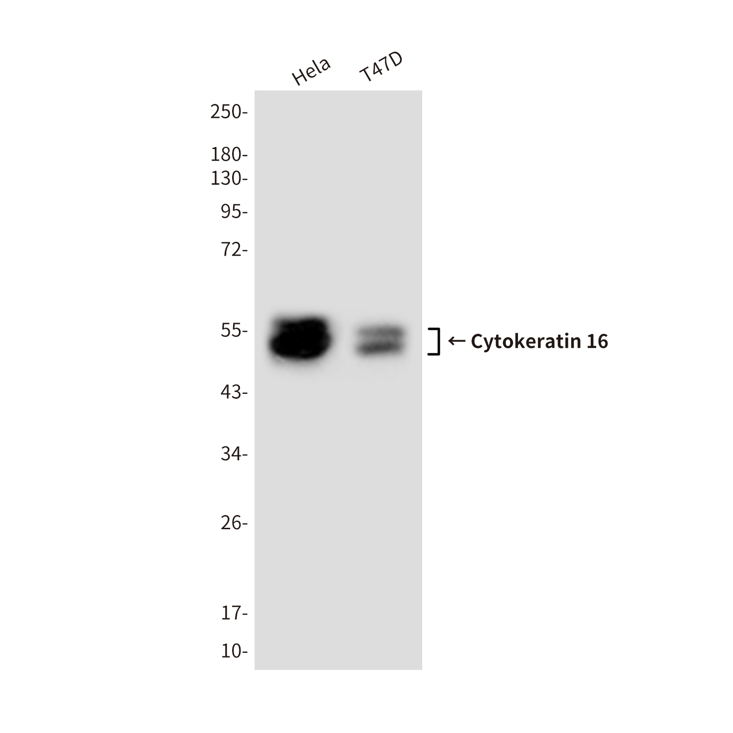Mouse Monoclonal Antibody to Cytokeratin 16