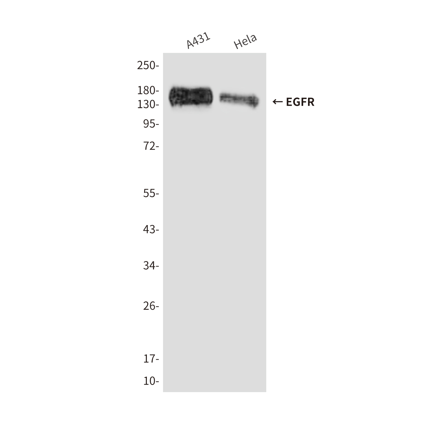 Mouse Monoclonal Antibody to EGFR