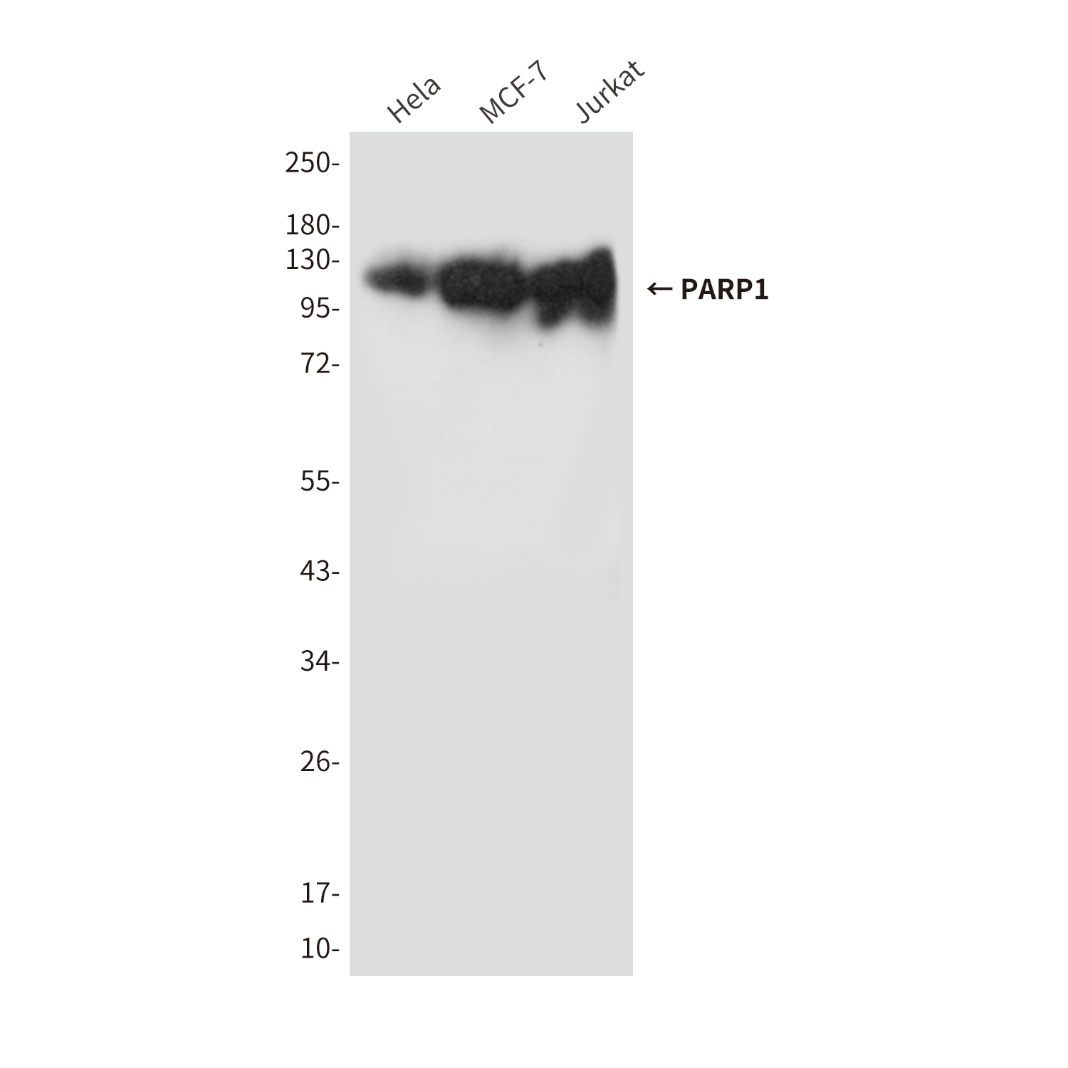 Mouse Monoclonal Antibody to PARP1