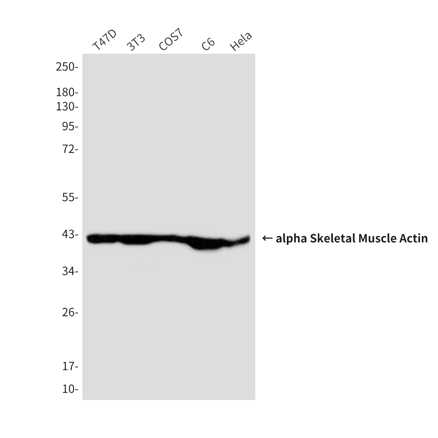 Mouse Monoclonal Antibody to alpha Skeletal Muscle Actin