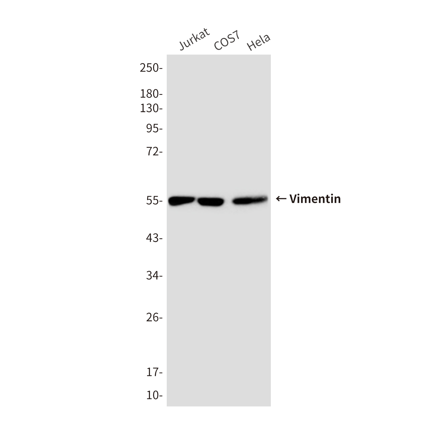 Mouse Monoclonal Antibody to Vimentin