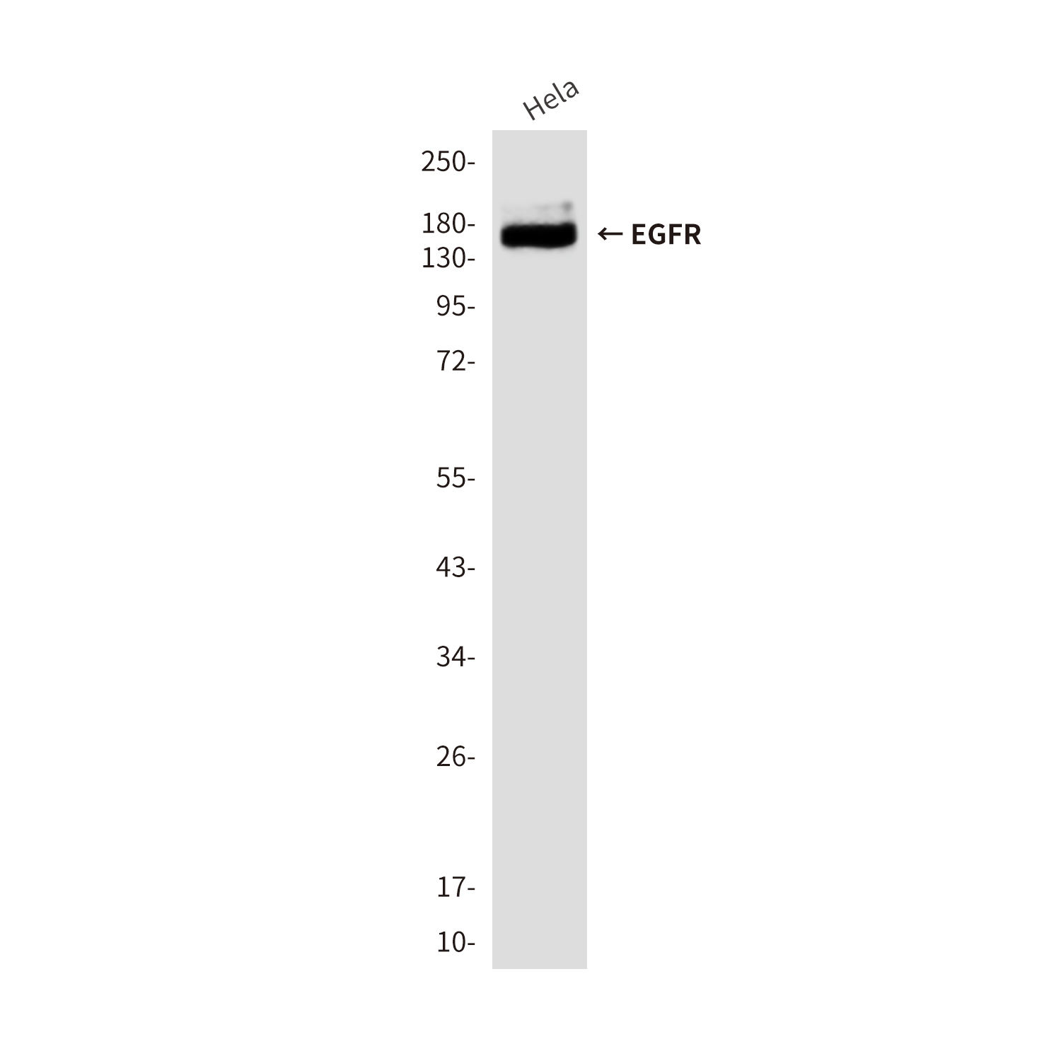 Mouse Monoclonal Antibody to EGFR