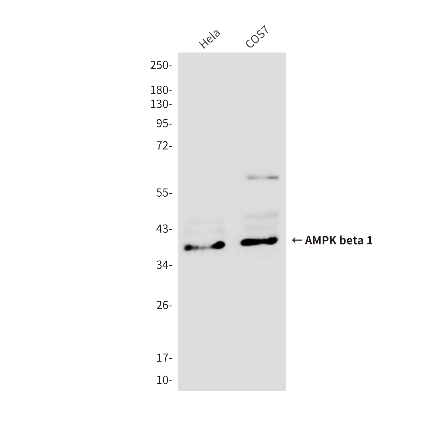 Mouse Monoclonal Antibody to AMPK beta 1