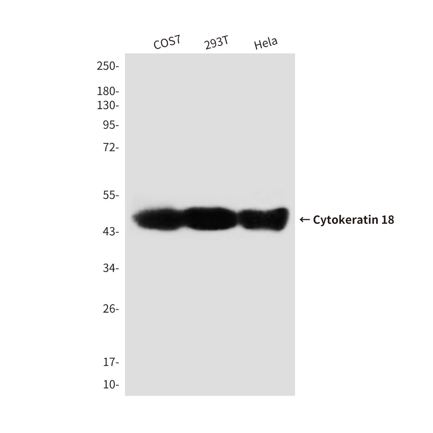 Mouse Monoclonal Antibody to Cytokeratin 18