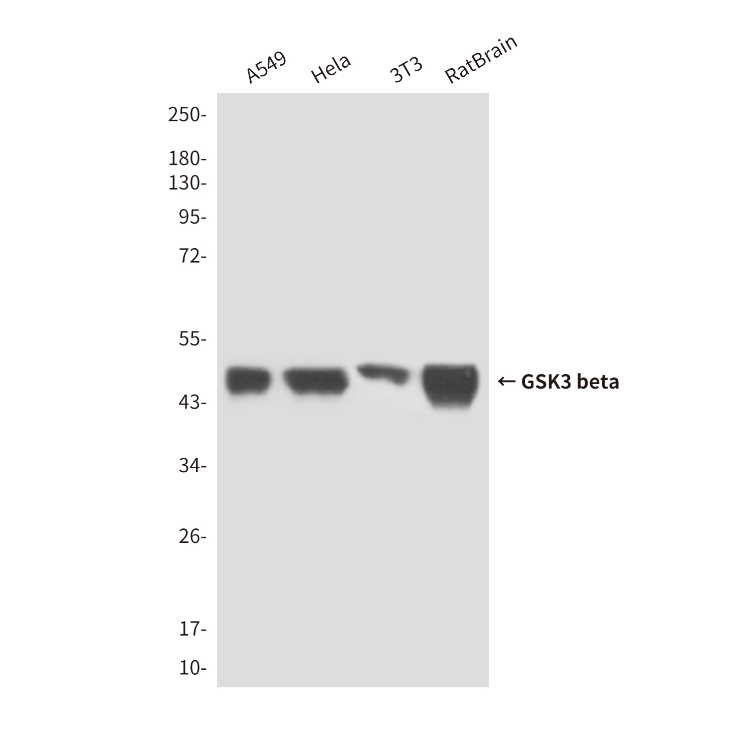 Mouse Monoclonal Antibody to GSK3 beta