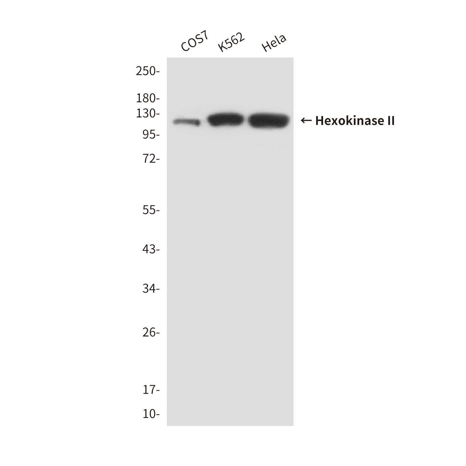Mouse Monoclonal Antibody to Hexokinase II