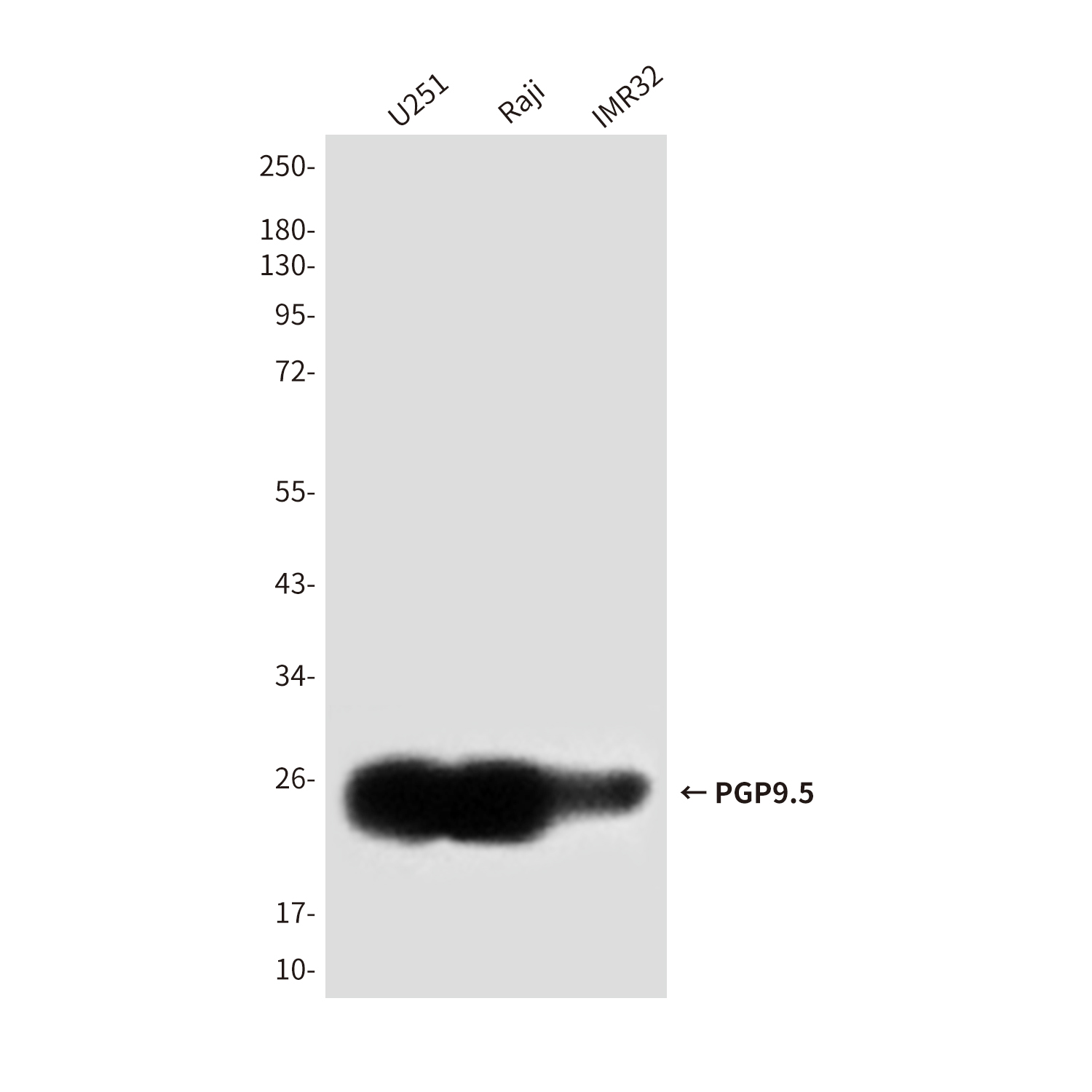 Mouse Monoclonal Antibody to PGP9.5