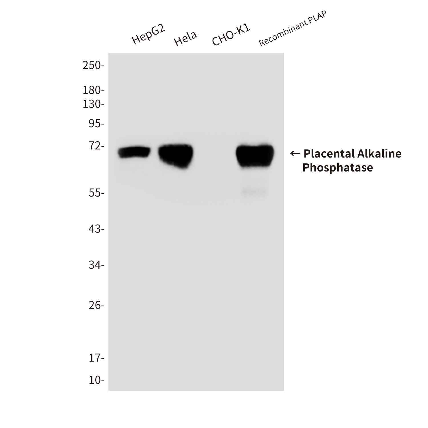 Mouse Monoclonal Antibody to Placental Alkaline Phosphatase
