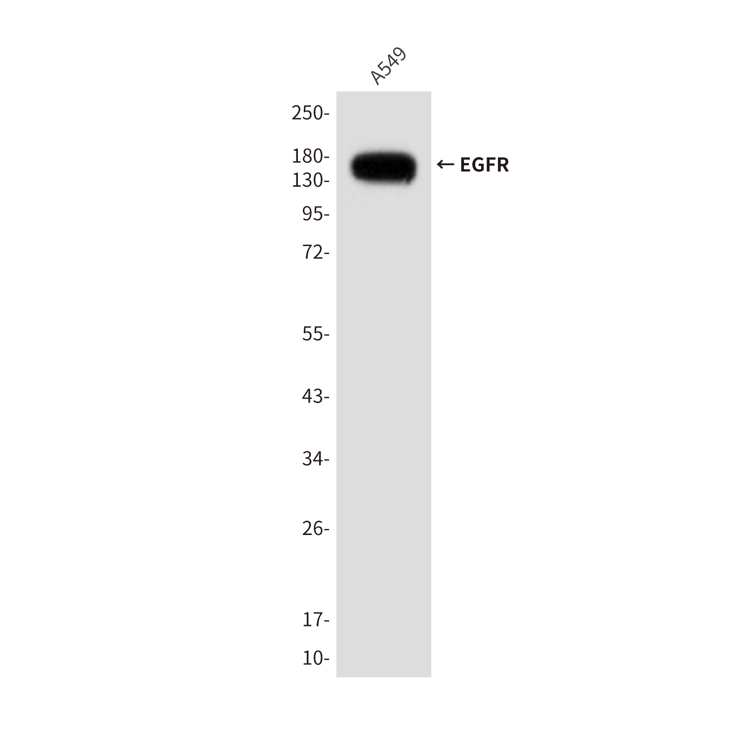 Mouse Monoclonal Antibody to EGFR