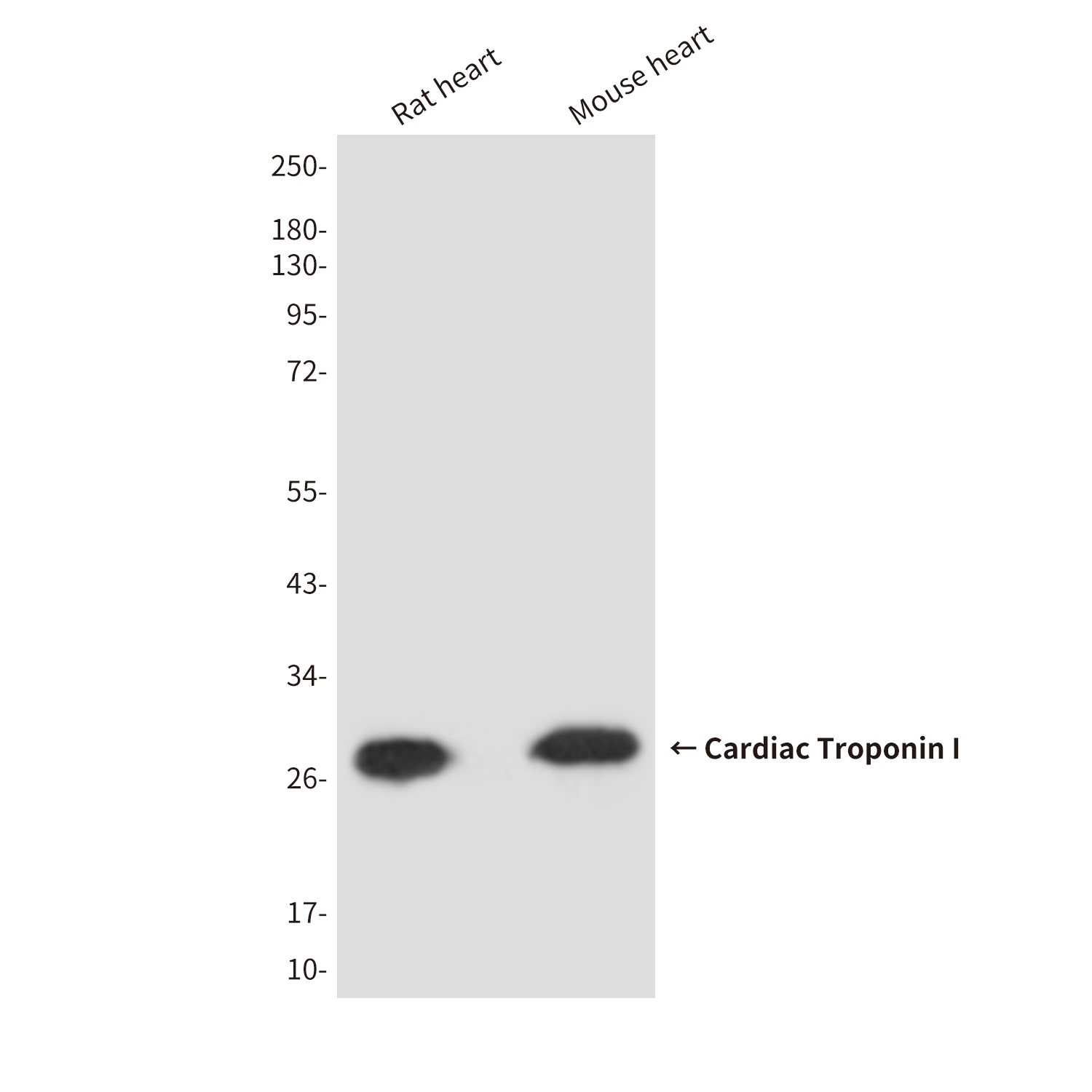 Mouse Monoclonal Antibody to Cardiac Troponin I