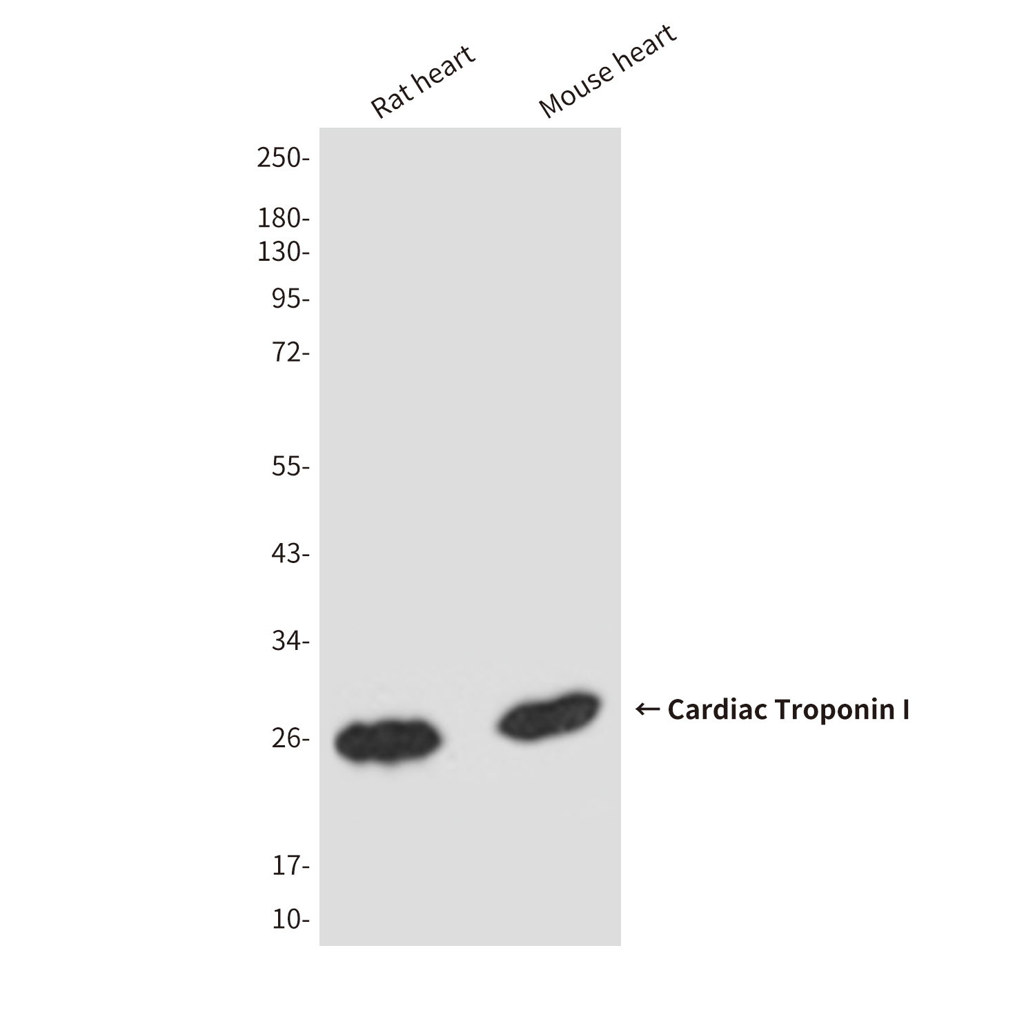 Mouse Monoclonal Antibody to Cardiac Troponin I