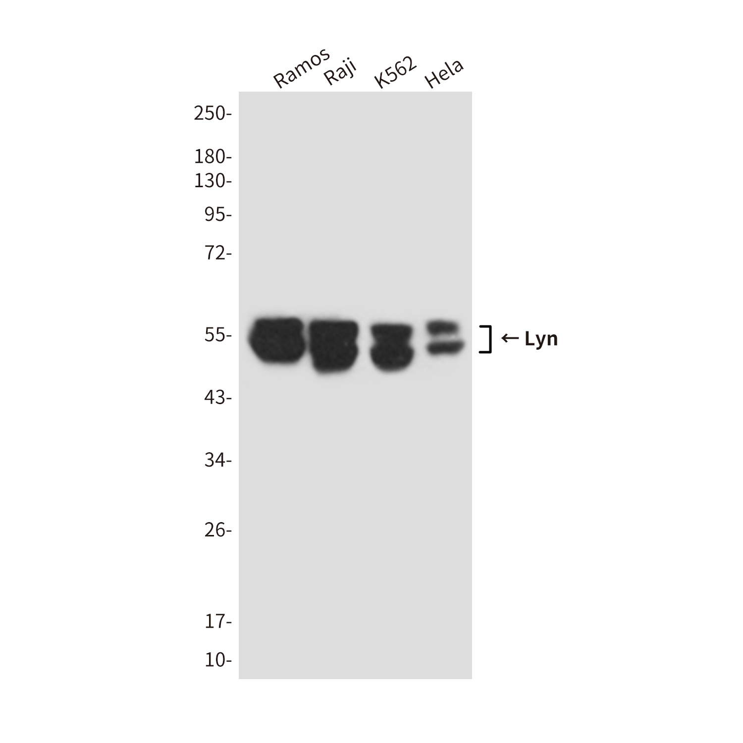 Mouse Monoclonal Antibody to Lyn