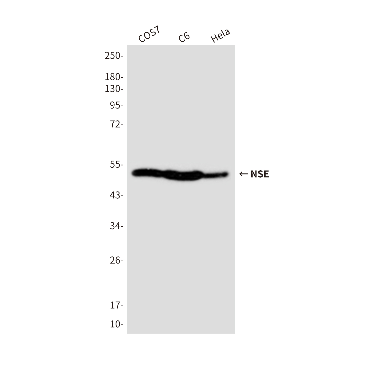 Mouse Monoclonal Antibody to NSE