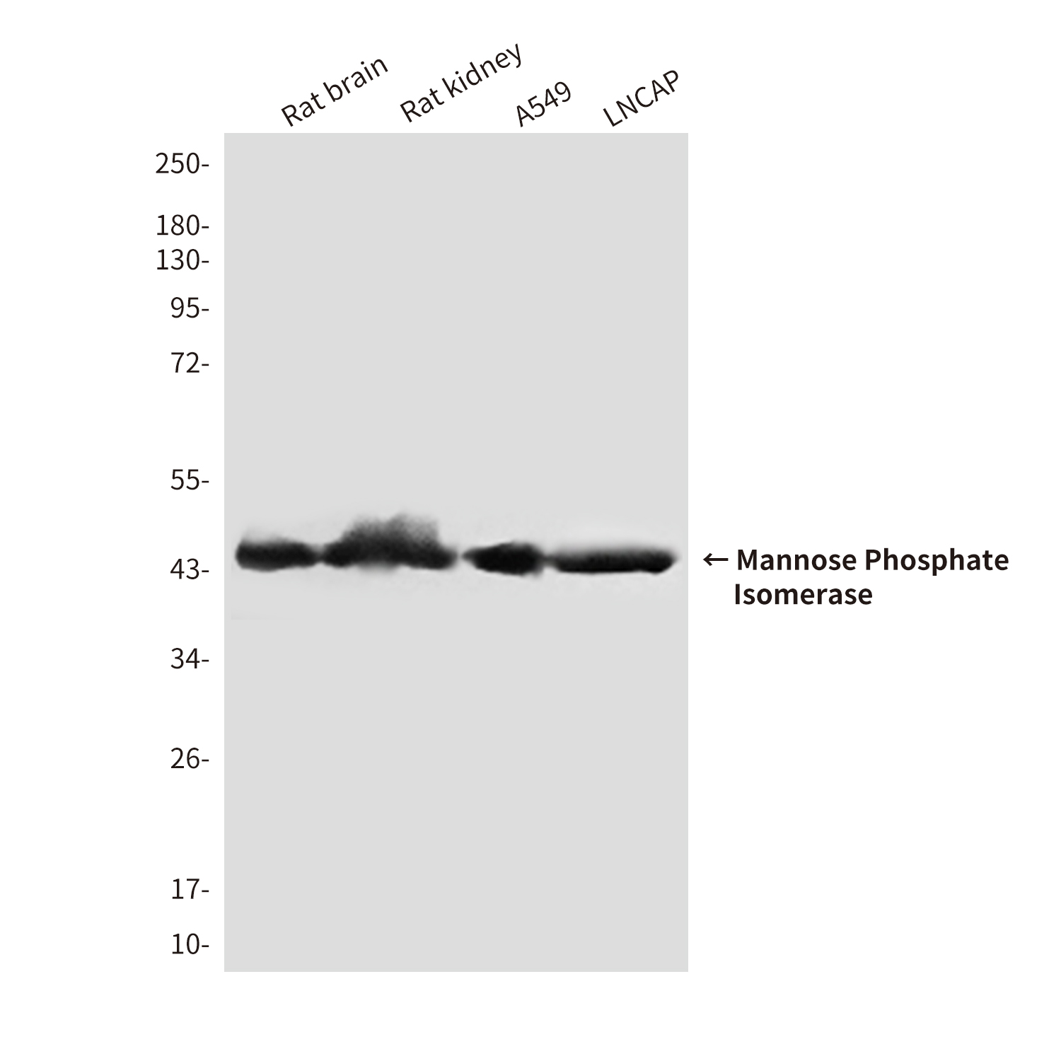 Mouse Monoclonal Antibody to Mannose Phosphate Isomerase