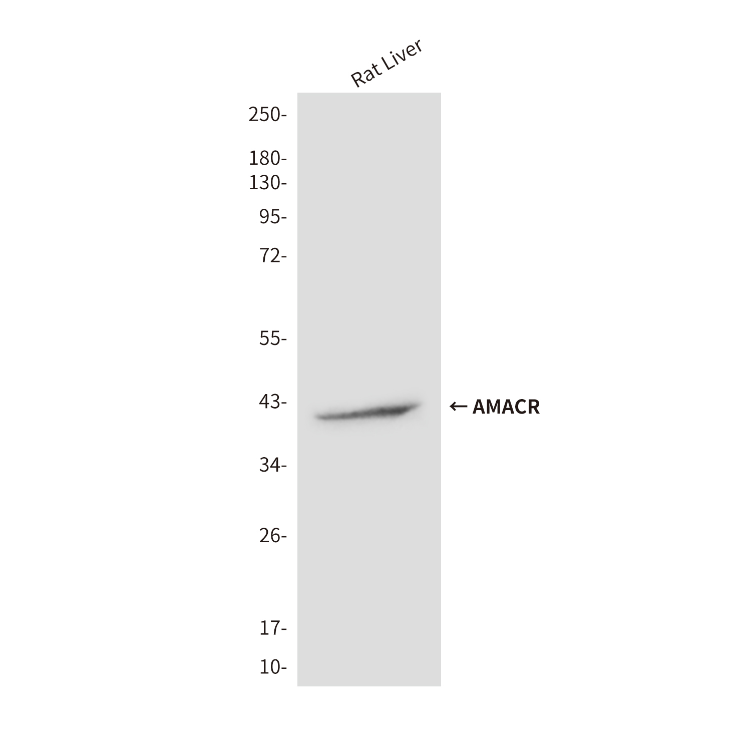 Mouse Monoclonal Antibody to AMACR